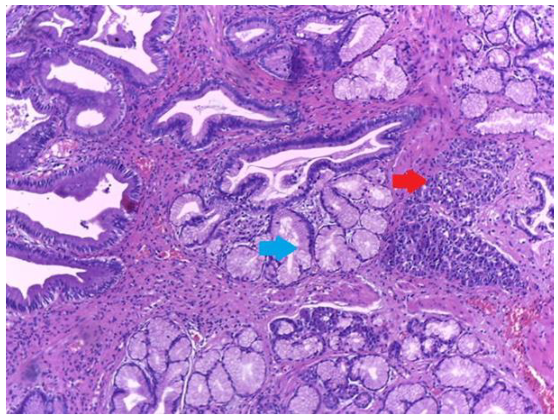 Medicina 59 01407 g011 Medicina 59 01407 g011