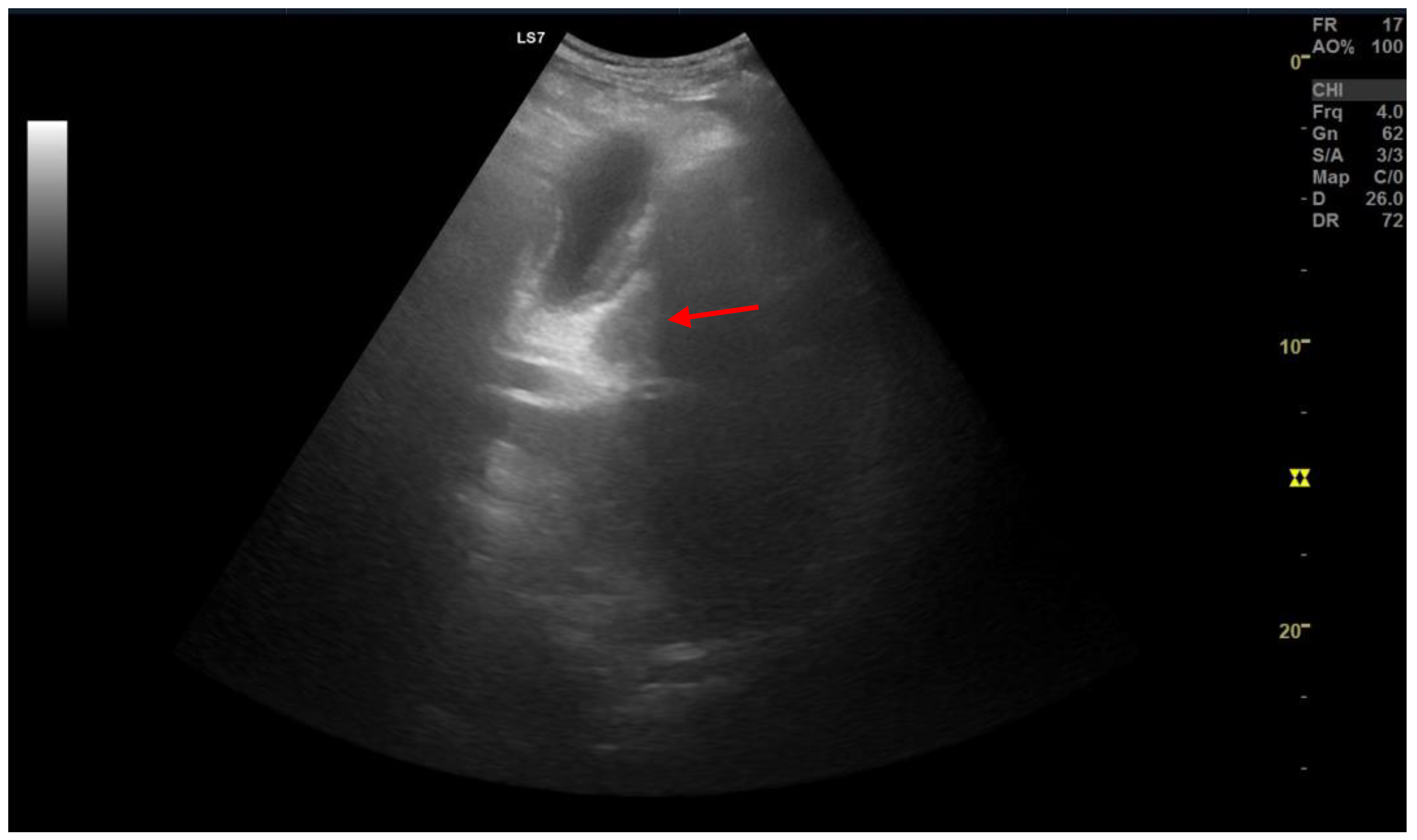 Medicina 59 01407 g013 Medicina 59 01407 g013