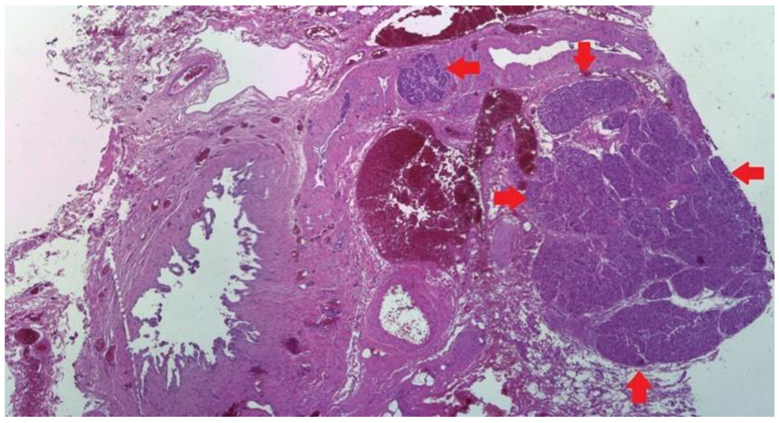 Medicina 59 01407 g014 Medicina 59 01407 g014