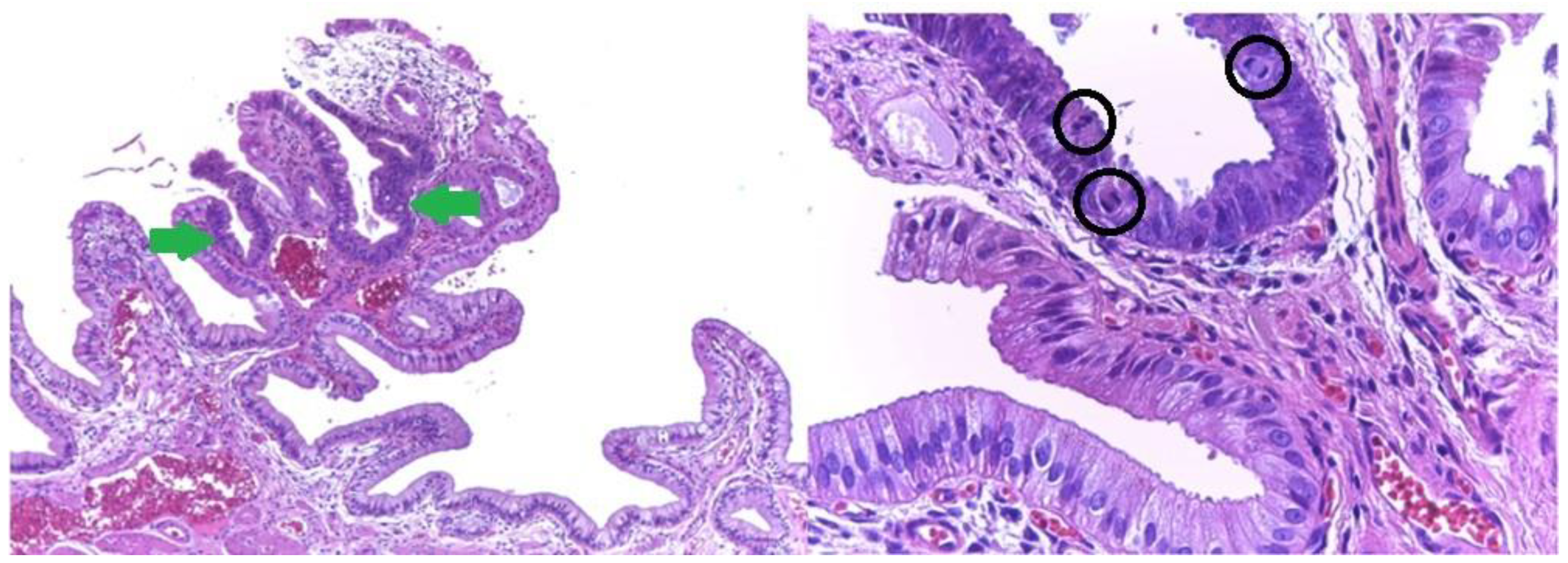 Medicina 59 01407 g017 Medicina 59 01407 g017