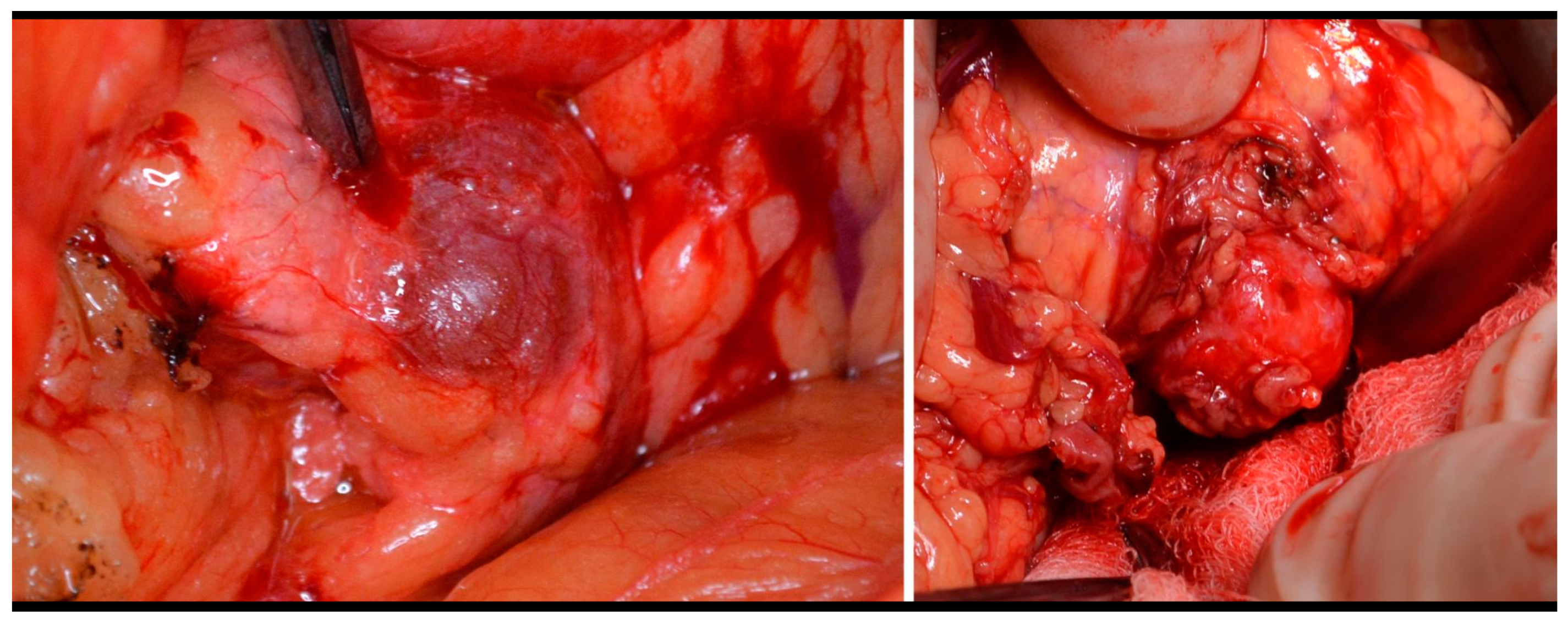 Medicina 59 01423 g003