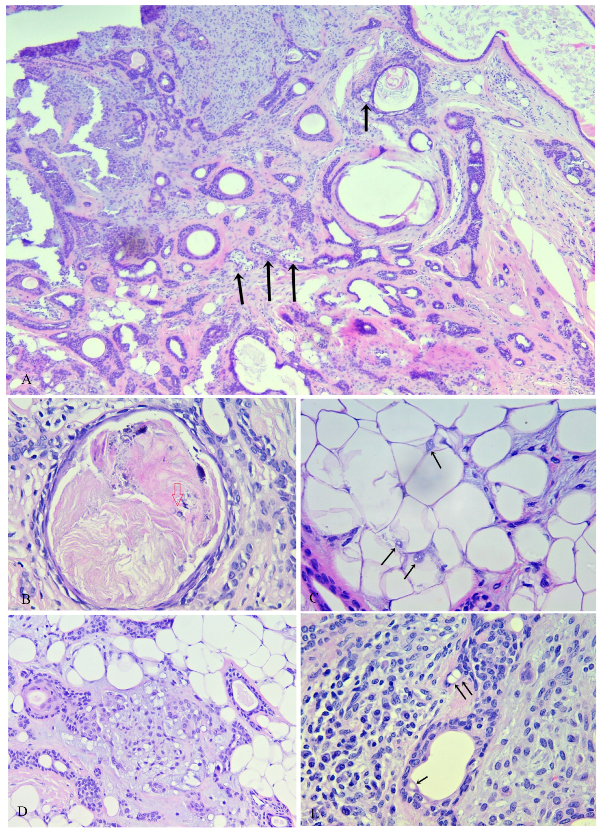 Medicina 59 01465 g005