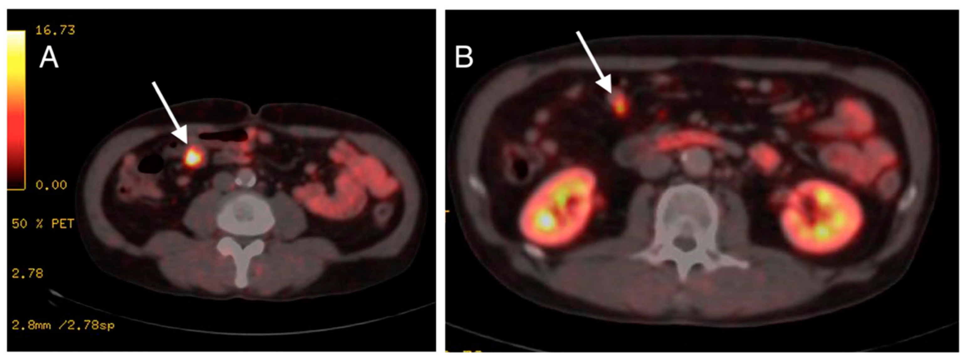 Medicina 59 01469 g004