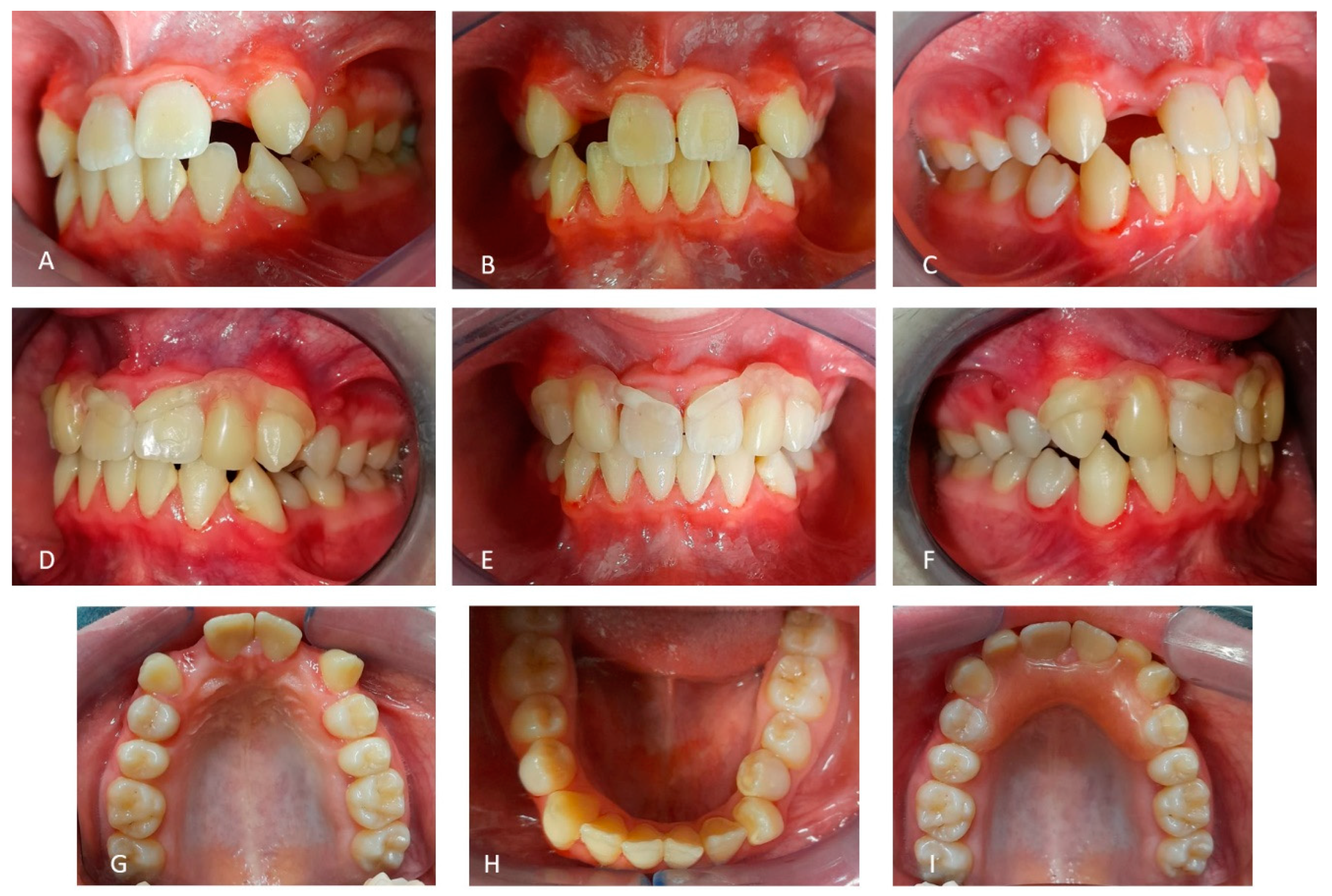 Medicina 59 01477 g009