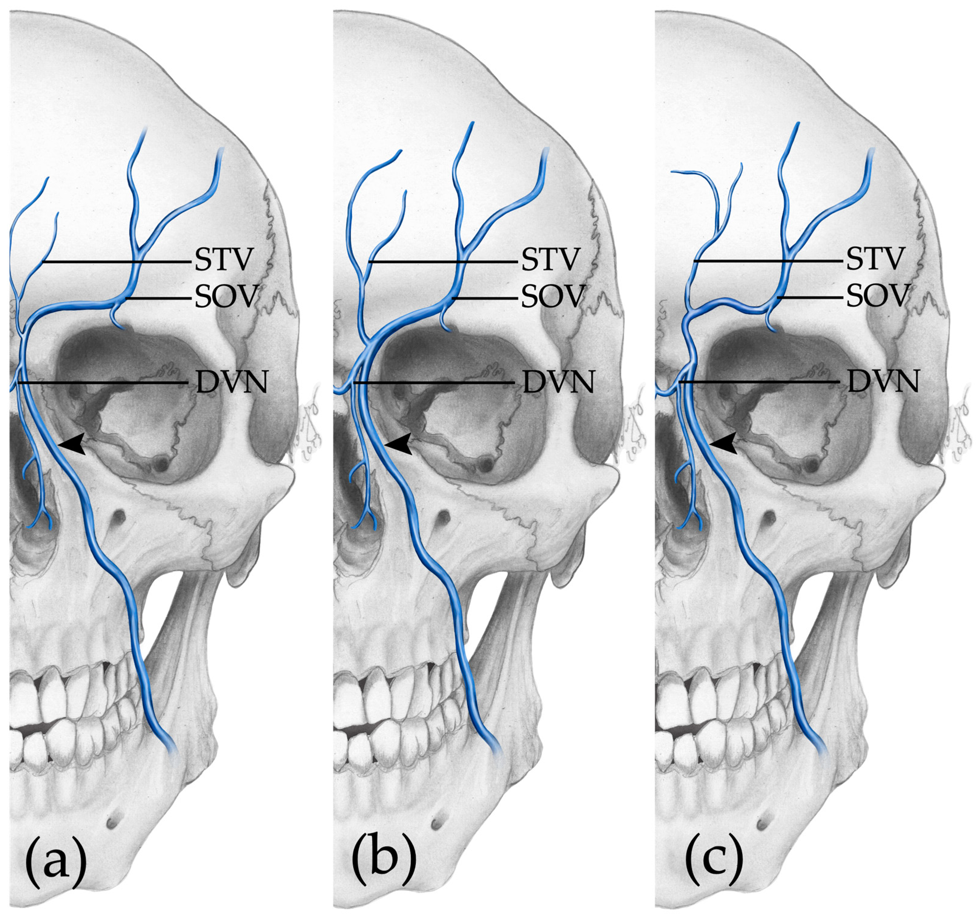 Medicina 59 01479 g004
