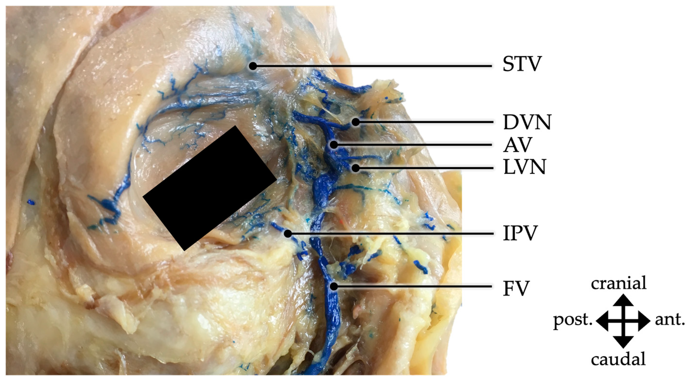 Medicina 59 01479 g005