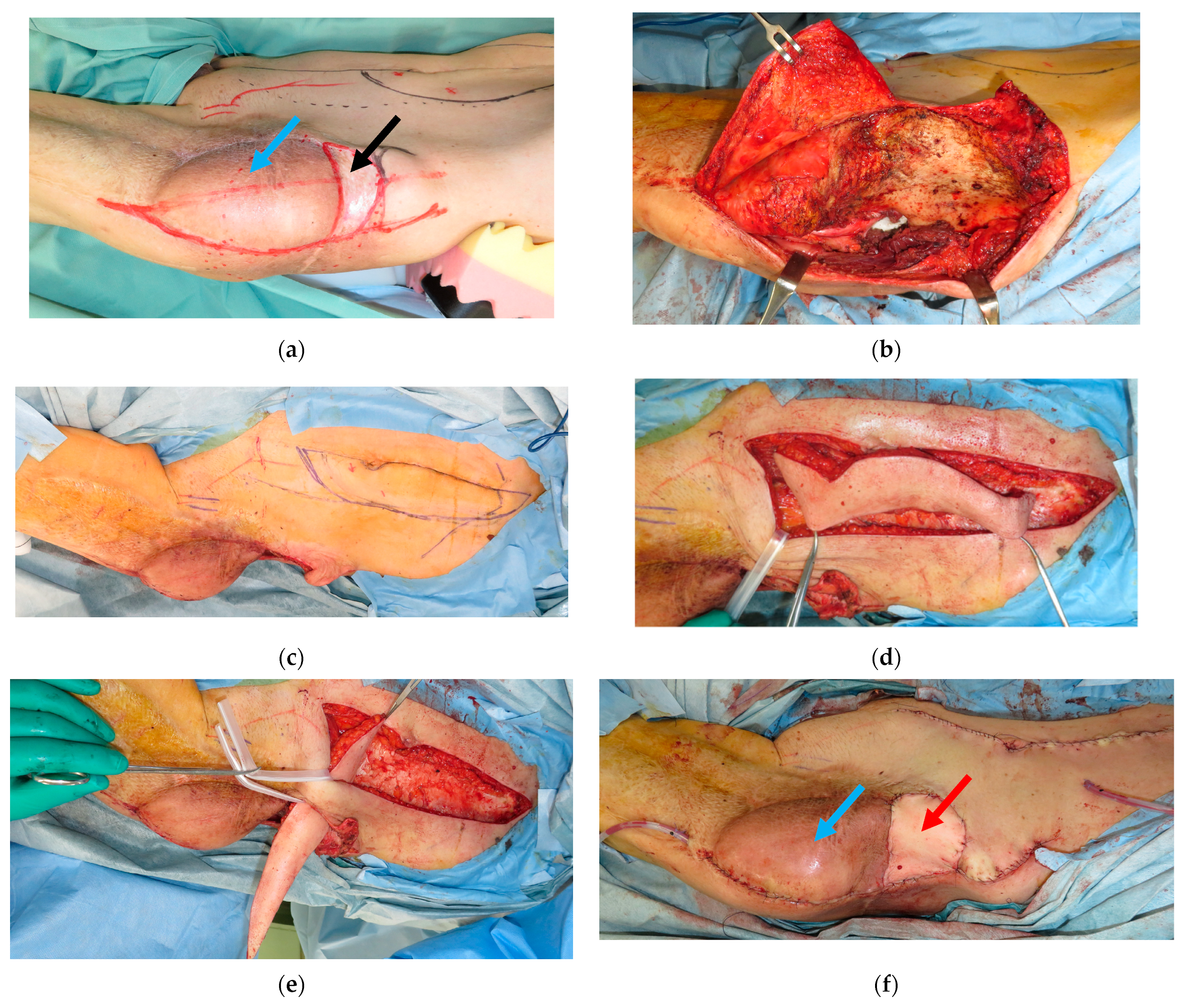 Medicina 59 01489 g002