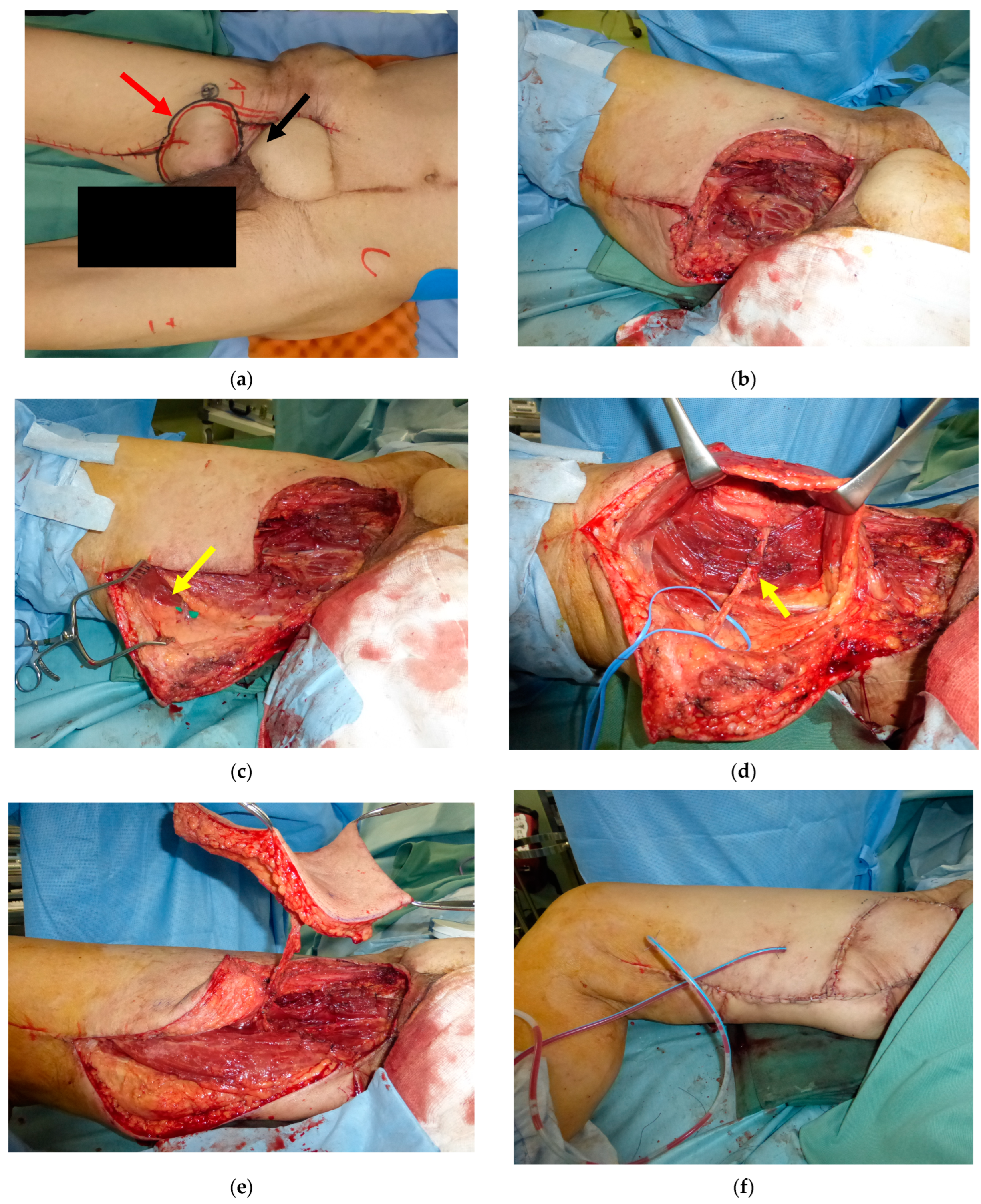 Medicina 59 01489 g004a