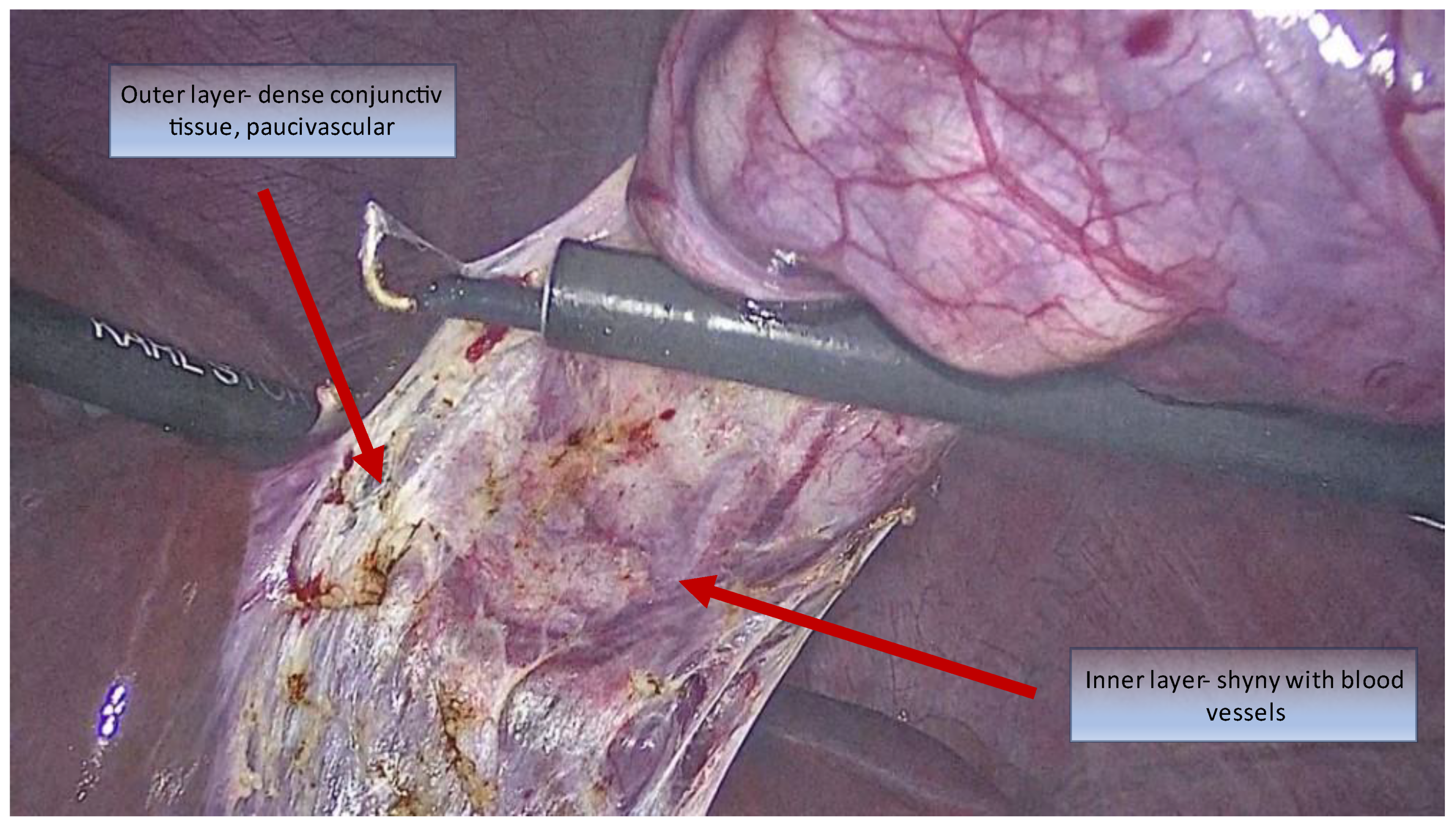 Medicina 59 01491 g004