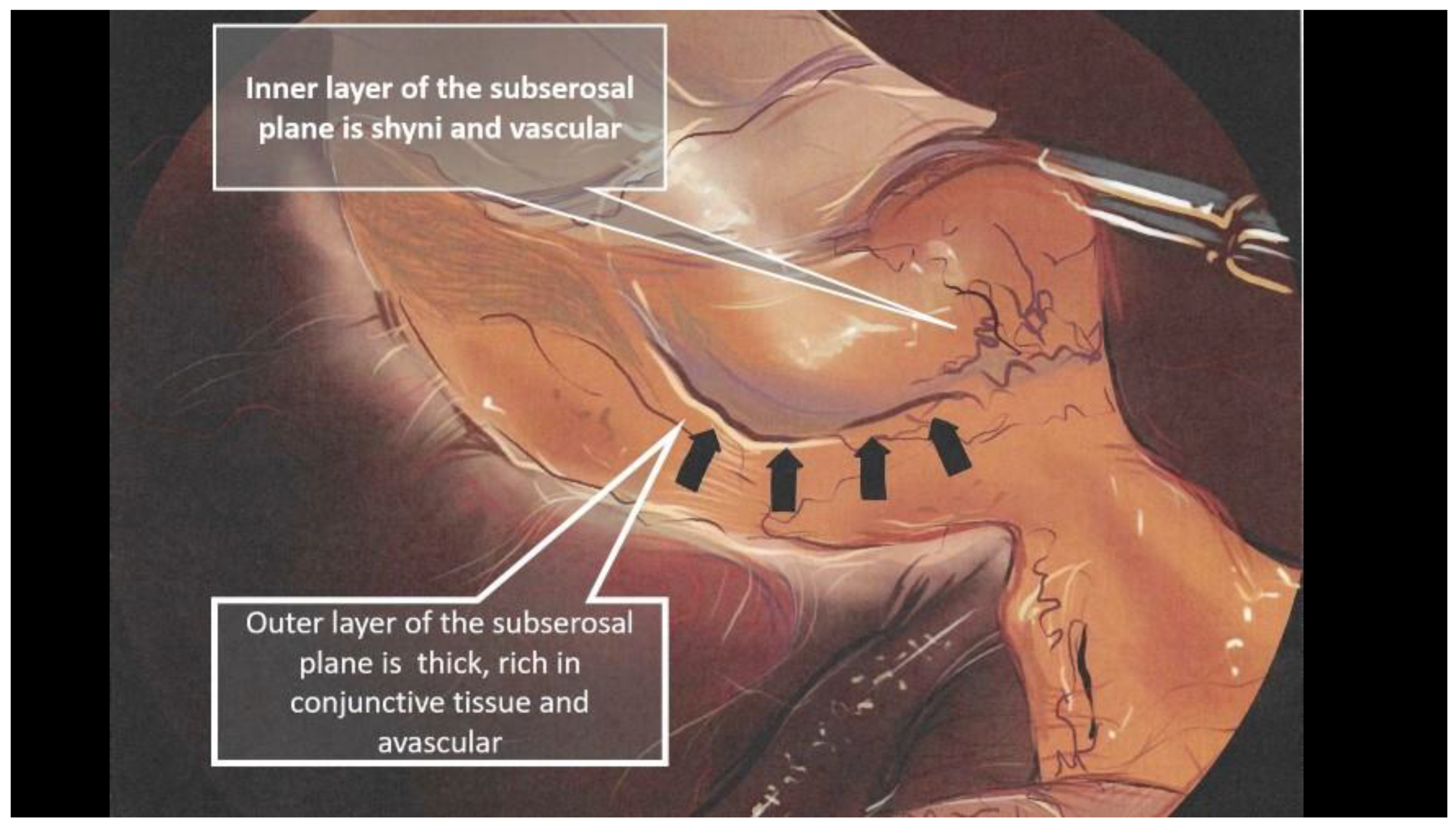 Medicina 59 01491 g005