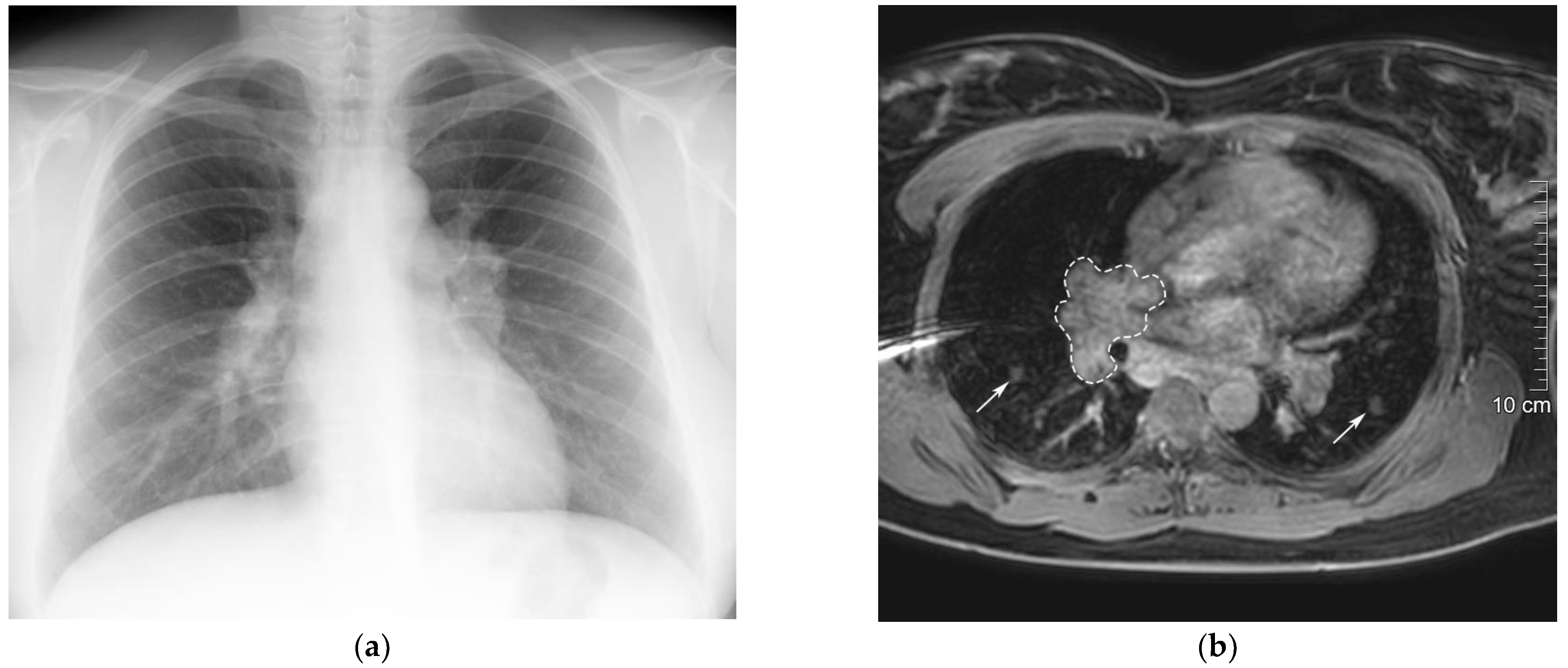 Medicina 59 01495 g002