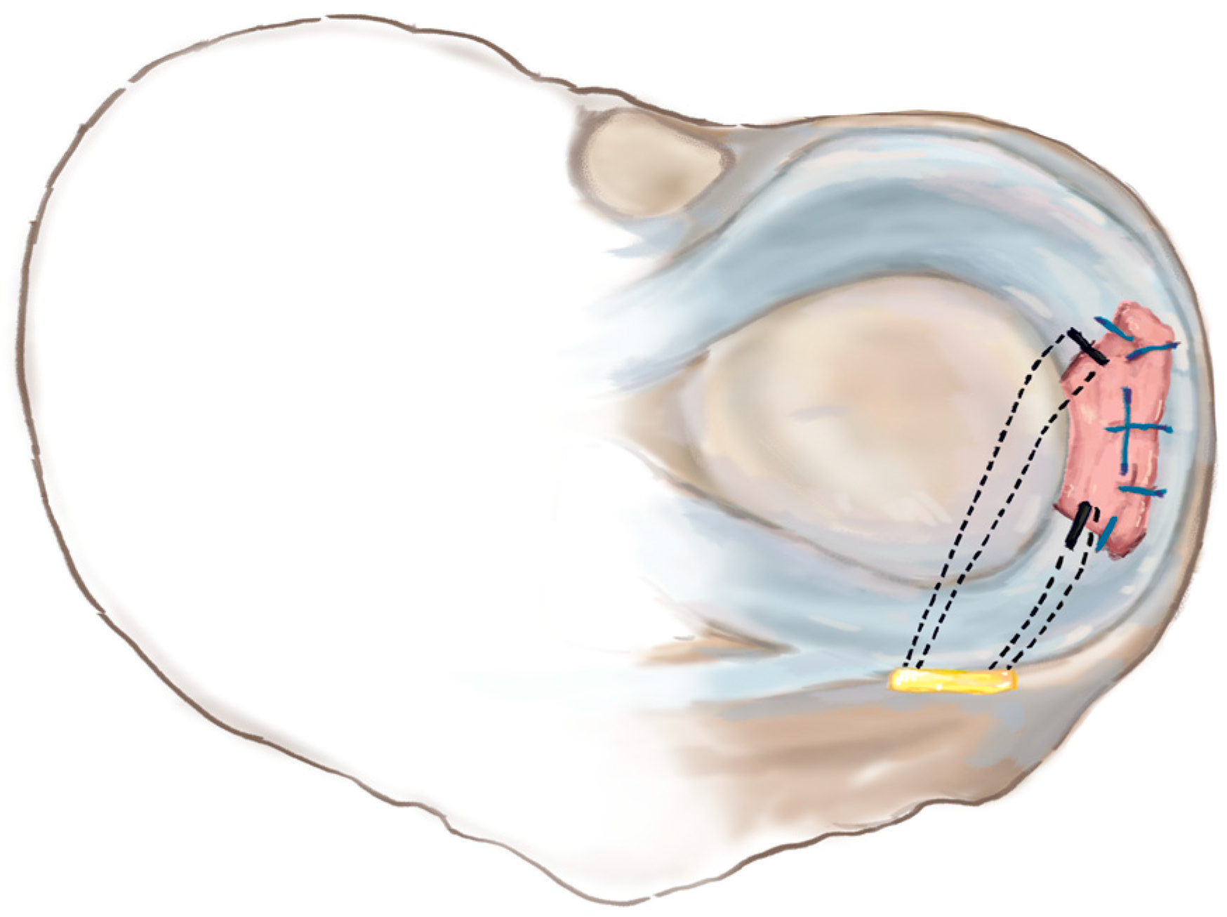 Medicina 59 01497 g004