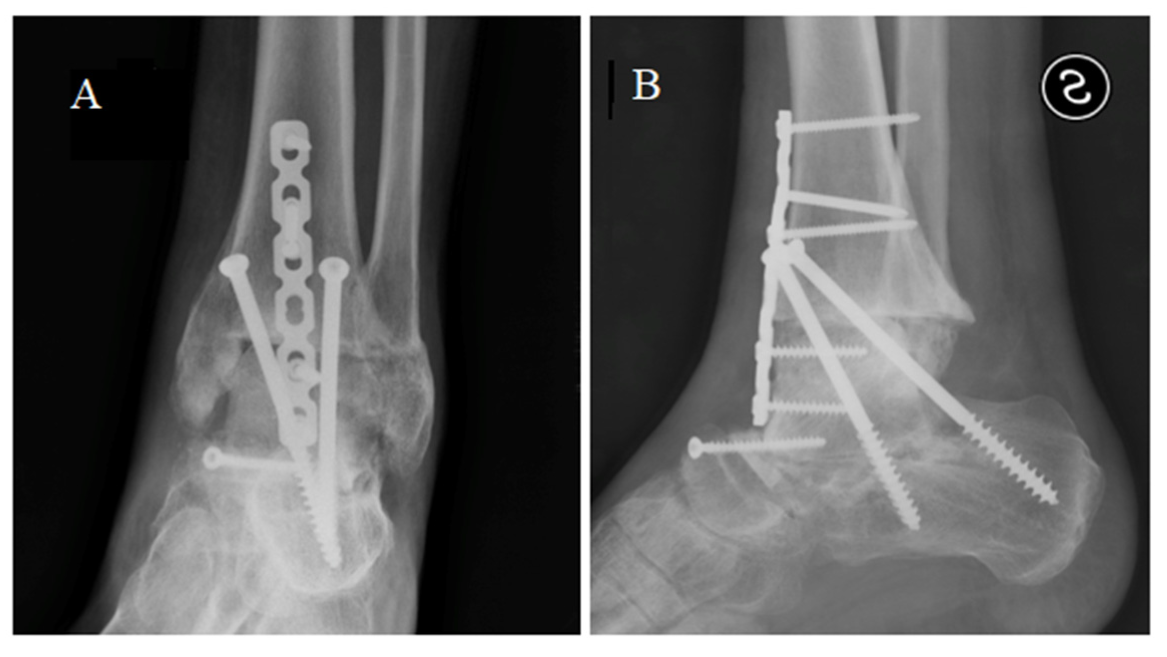 Medicina 59 01498 g006