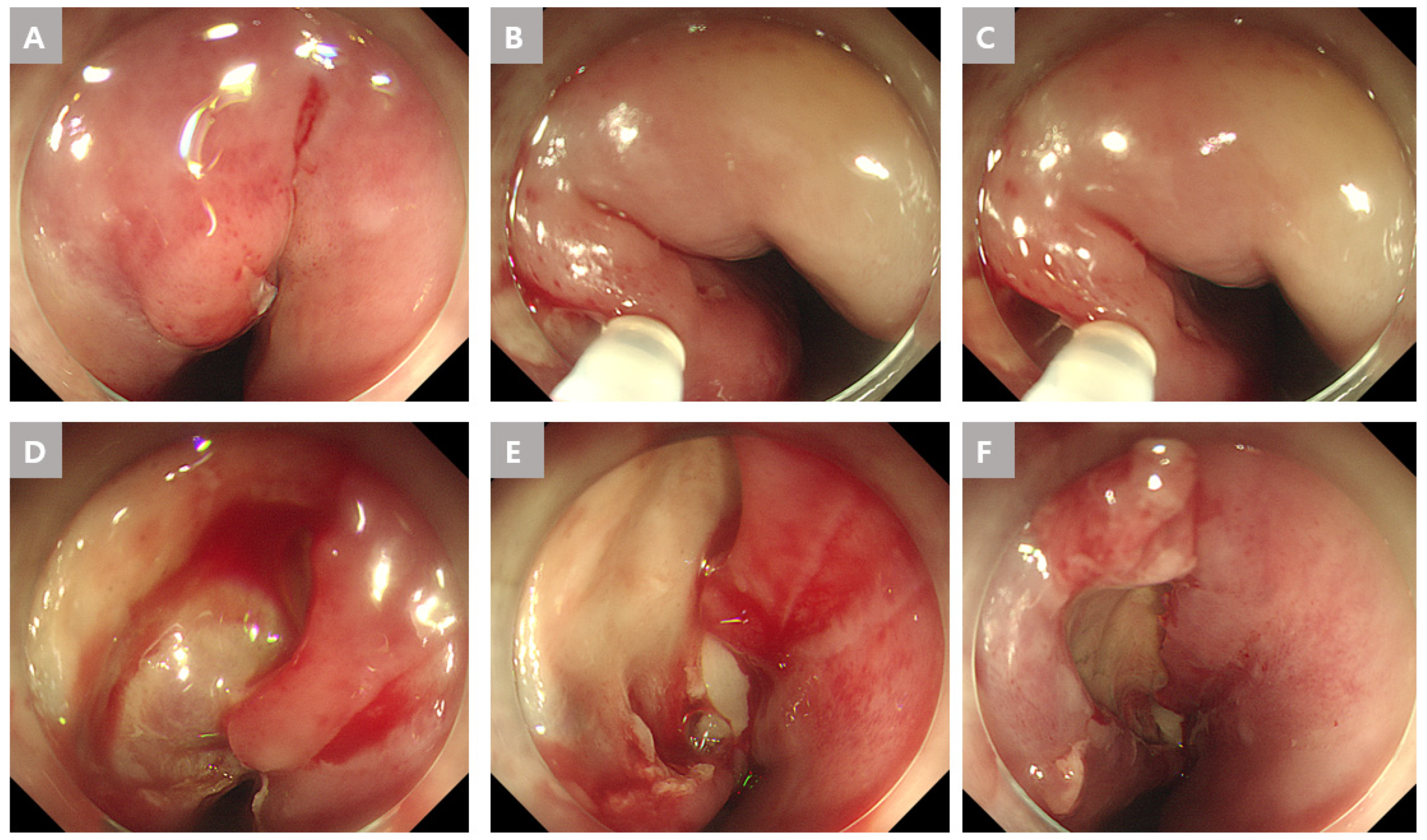Medicina 59 01504 g002
