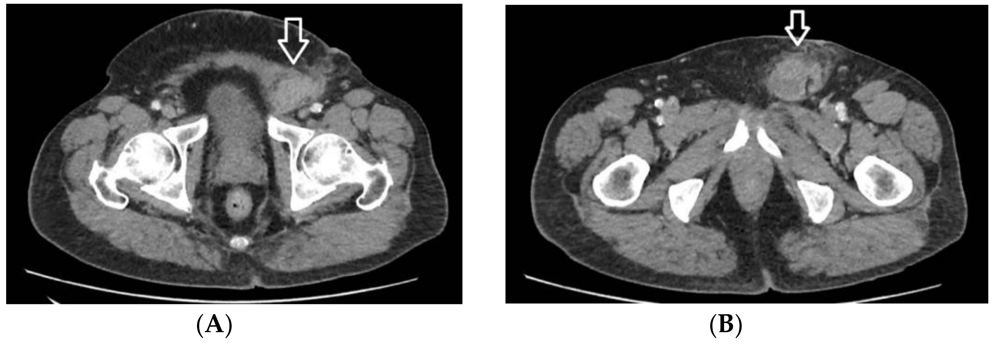 Medicina 59 01515 g001 Medicina 59 01515 g001