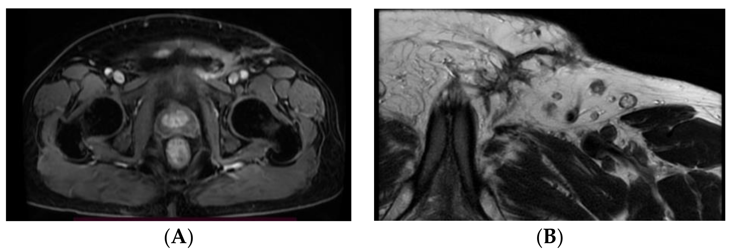 Medicina 59 01515 g004 Medicina 59 01515 g004