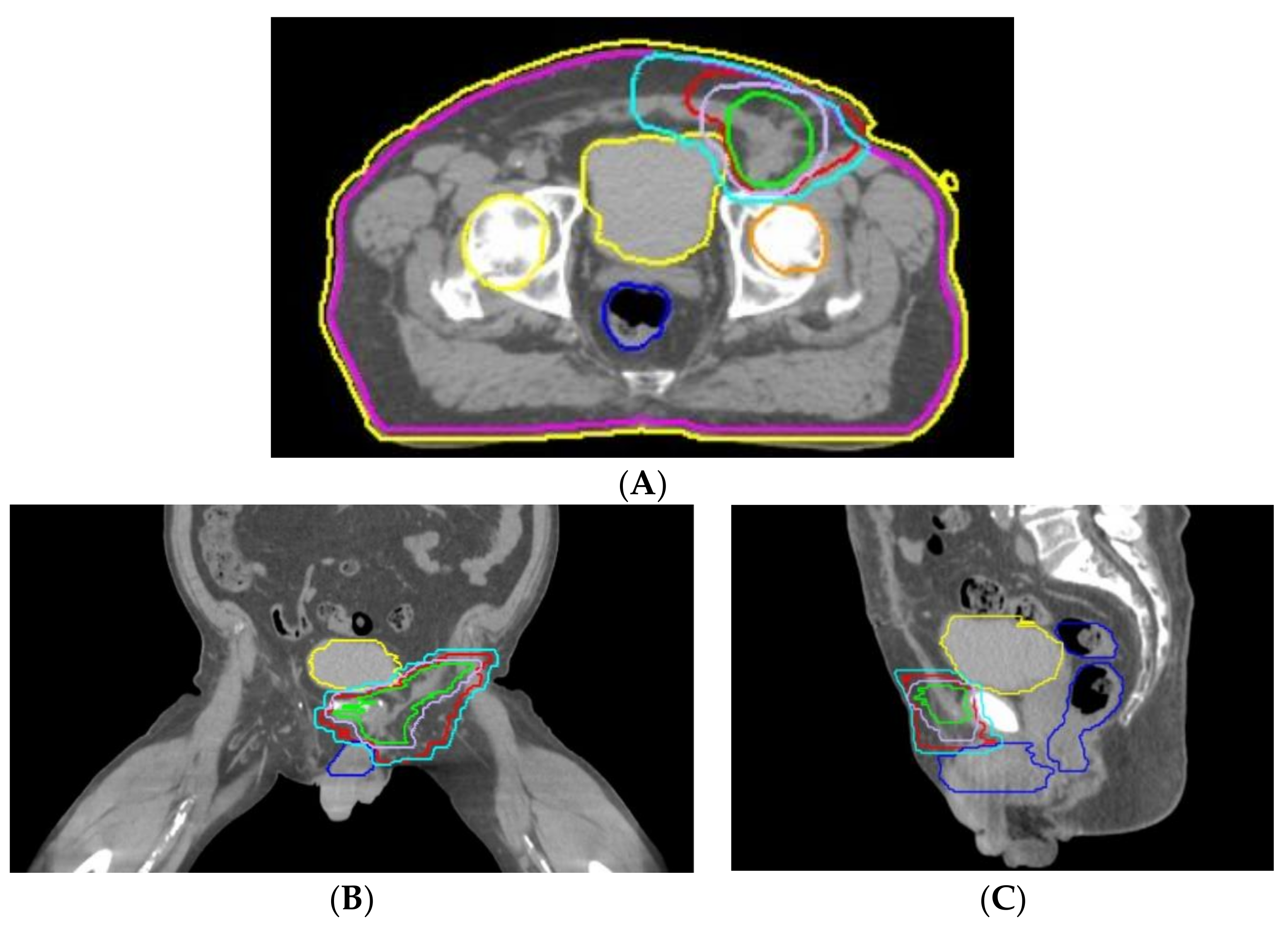Medicina 59 01515 g005 Medicina 59 01515 g005