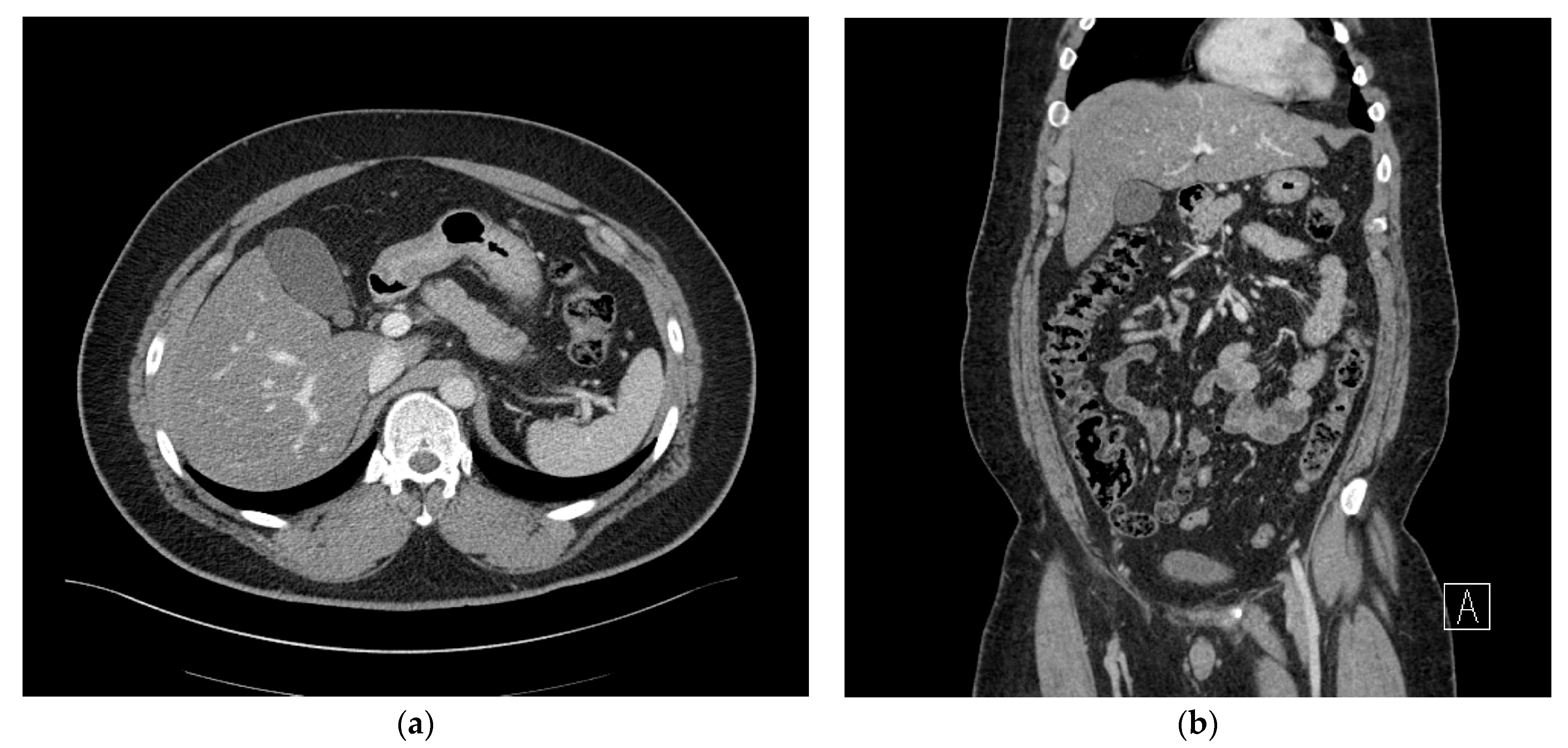 Medicina 59 01516 g001