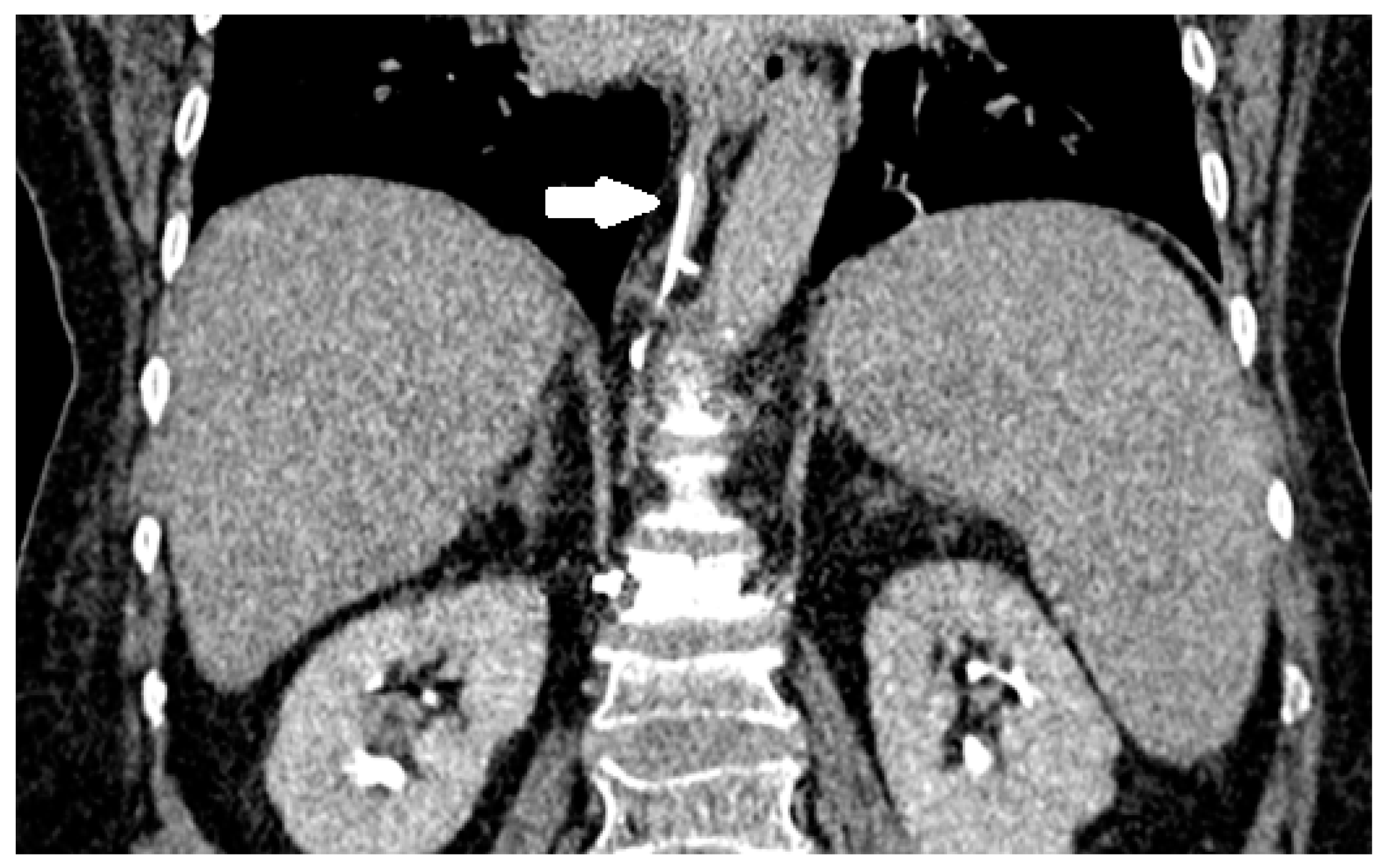 Medicina 59 01536 g005
