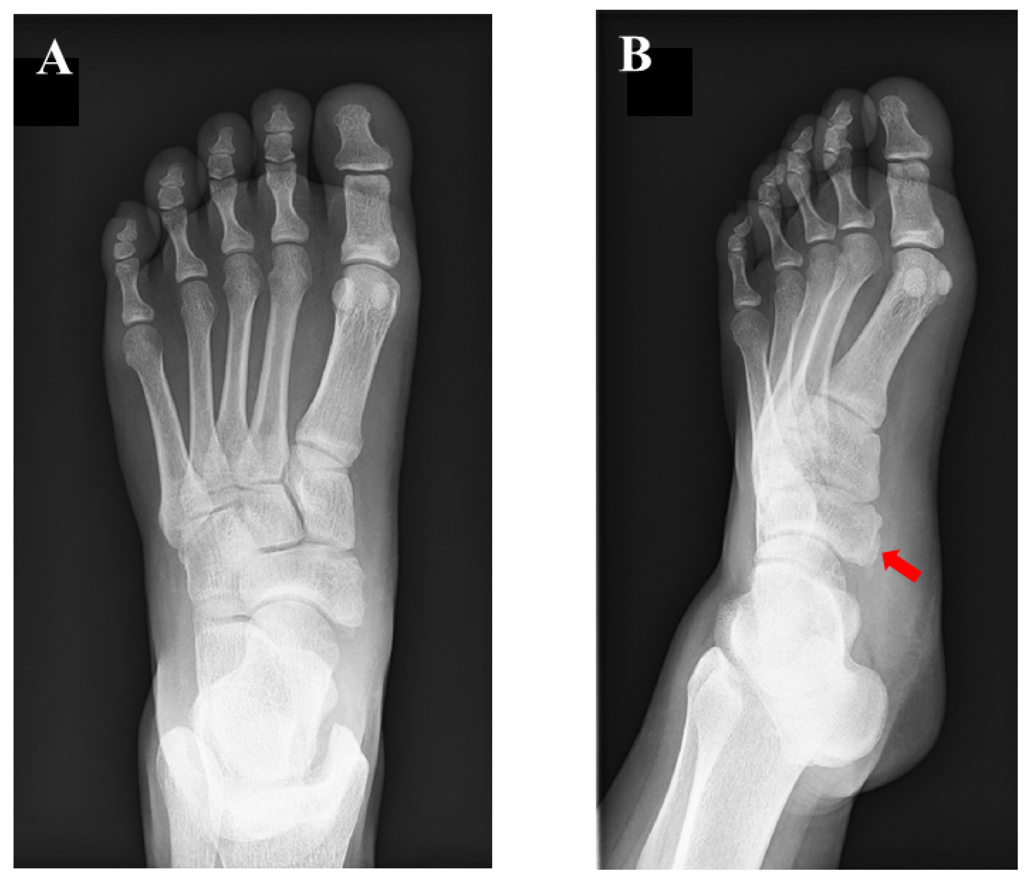 Navicular pain discount
