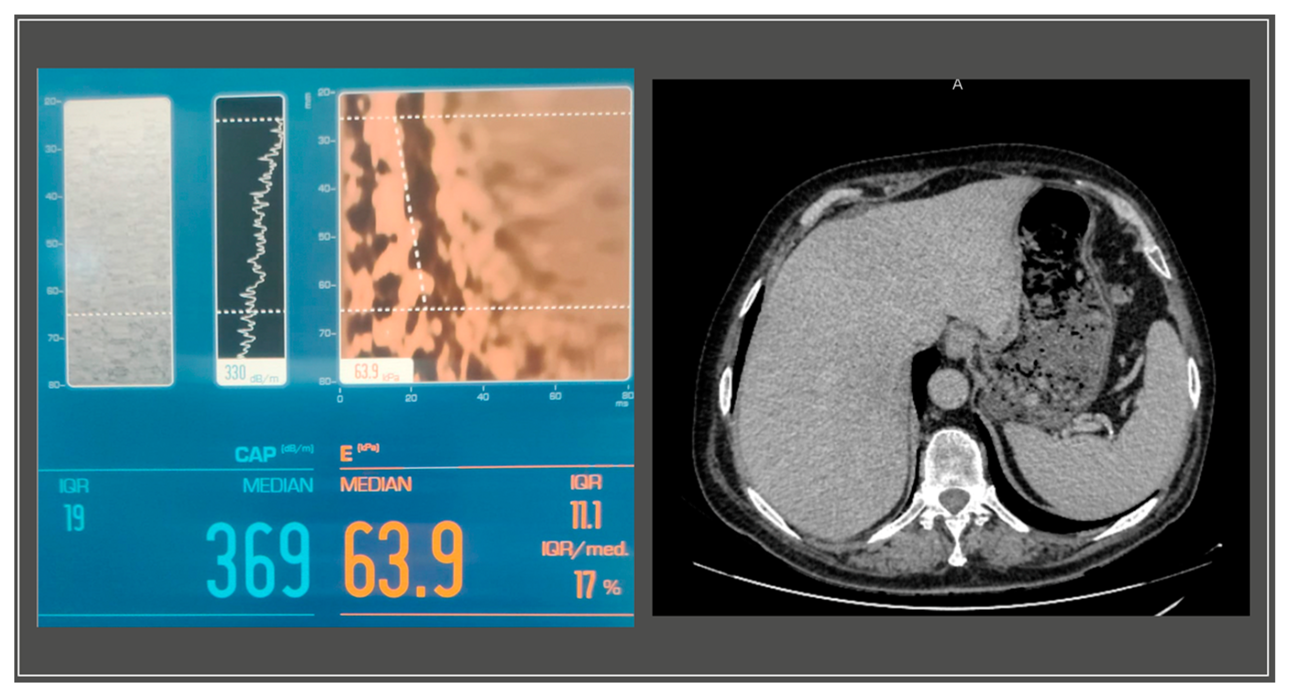 Medicina 59 01586 g003