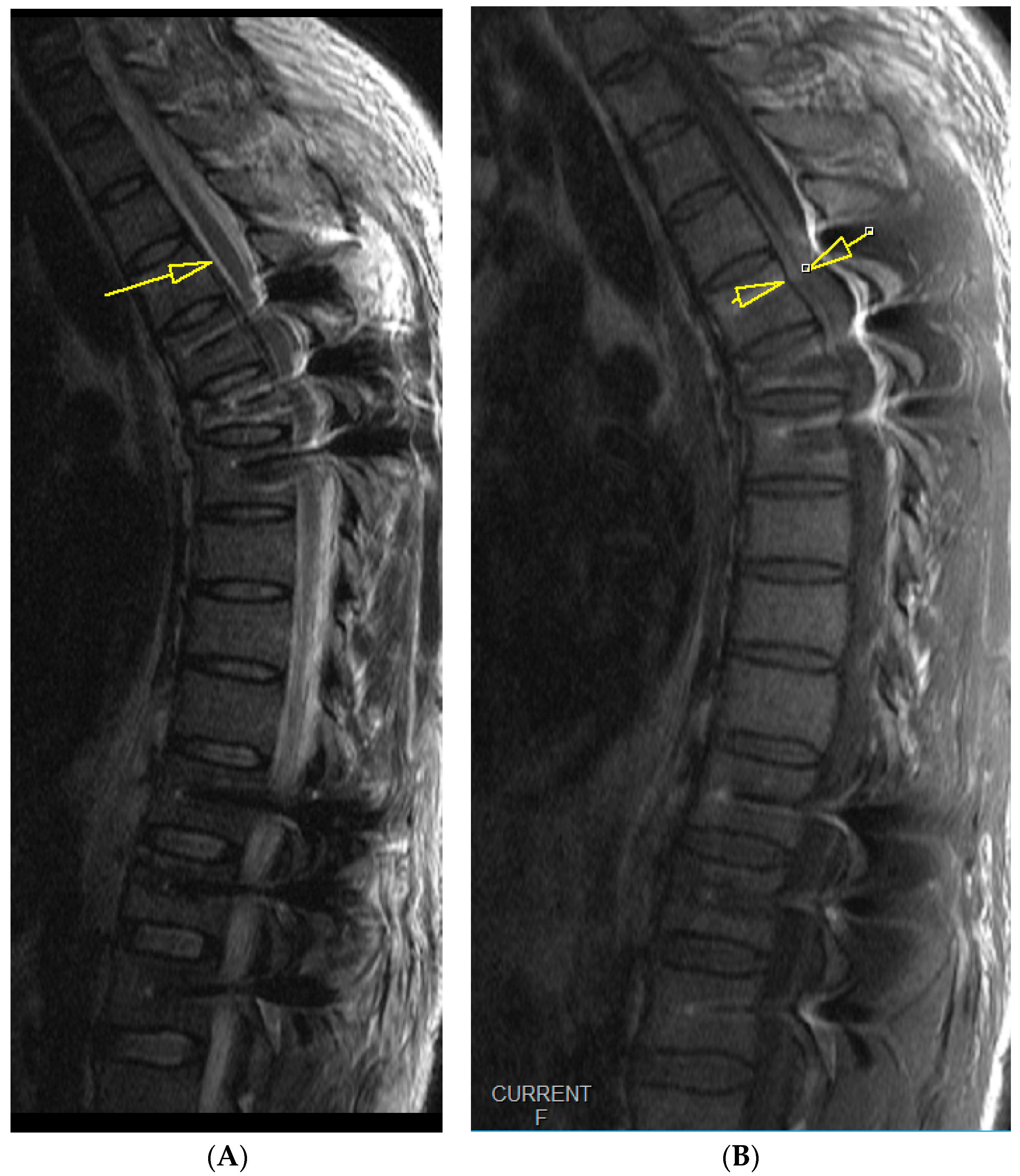 Medicina 59 01590 g005