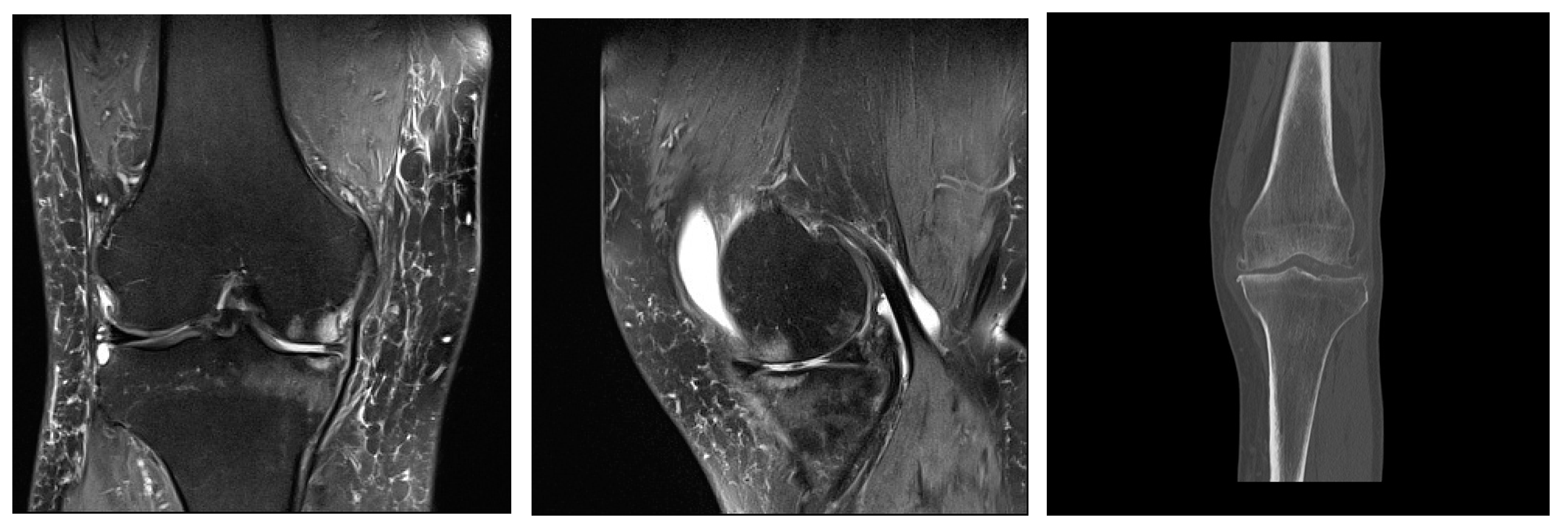 Medicina 59 01613 g002 Medicina 59 01613 g002