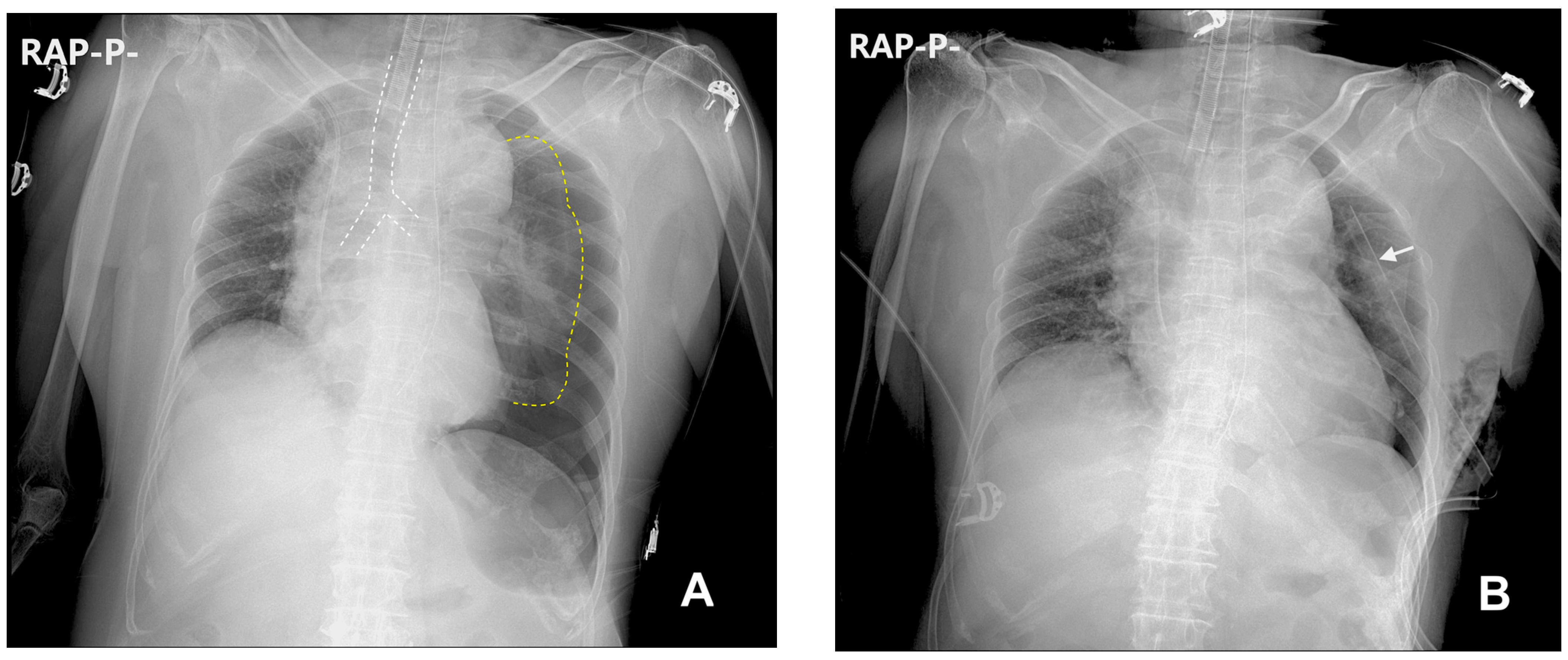 Medicina 59 01631 g002 Medicina 59 01631 g002