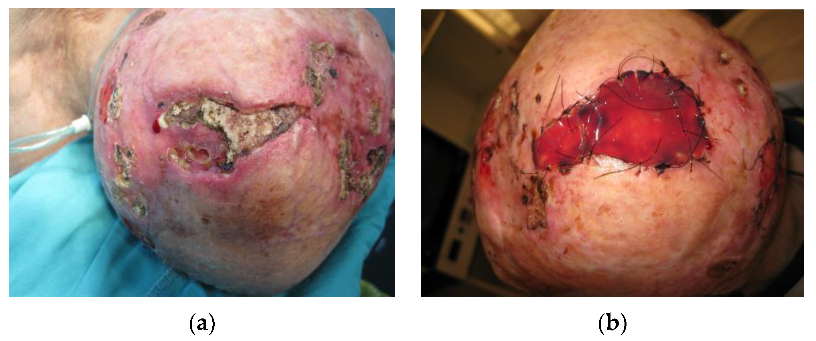 Medicina 59 01678 g004