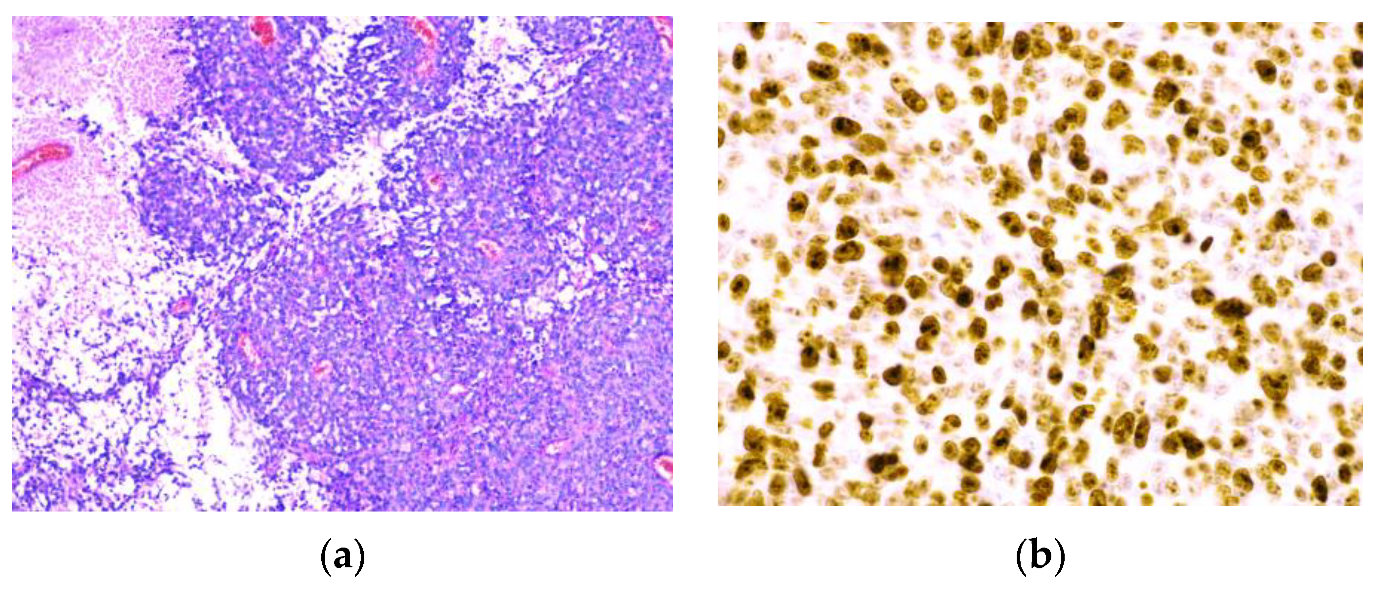 Medicina 59 01678 g005