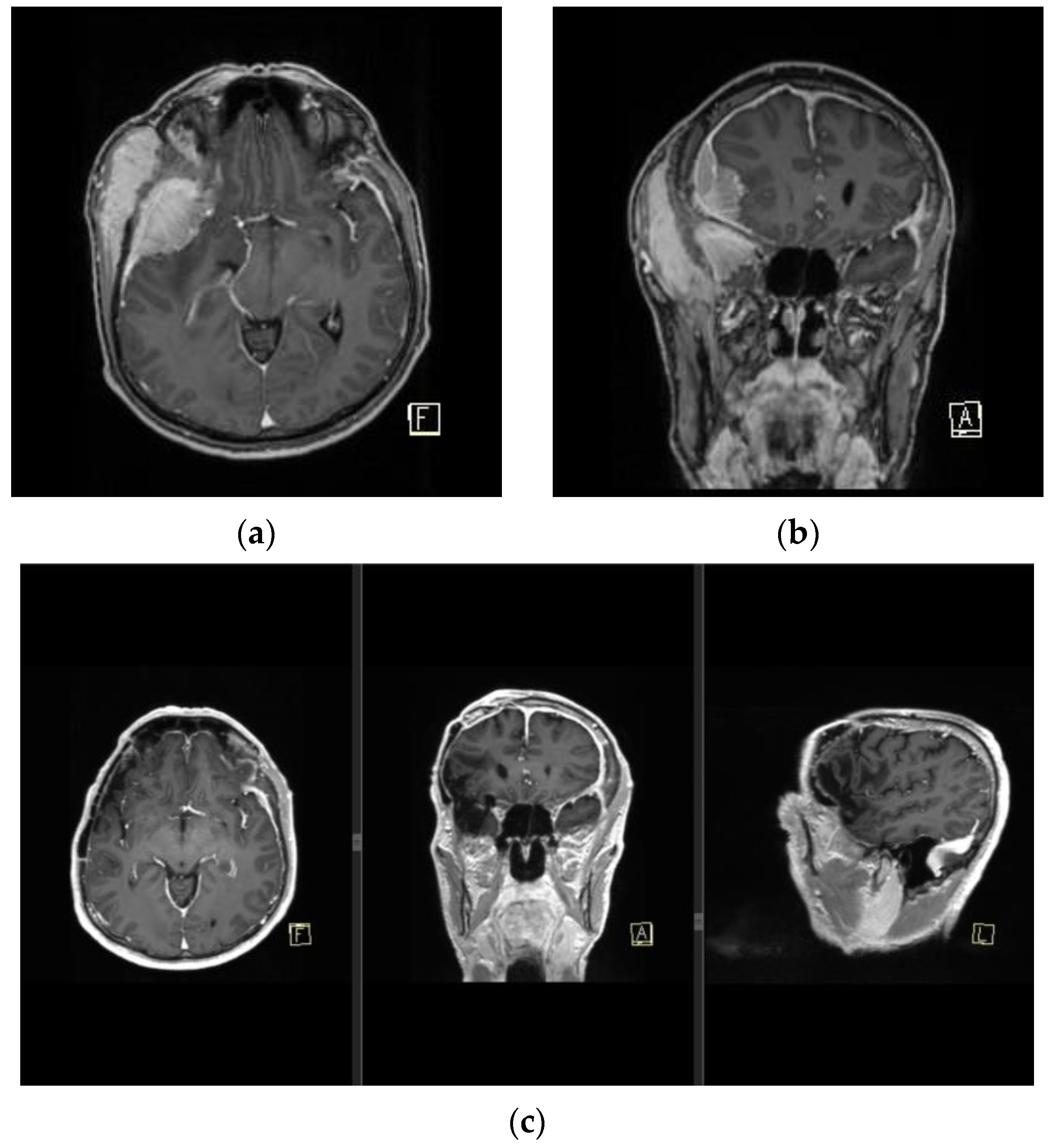 Medicina 59 01678 g006