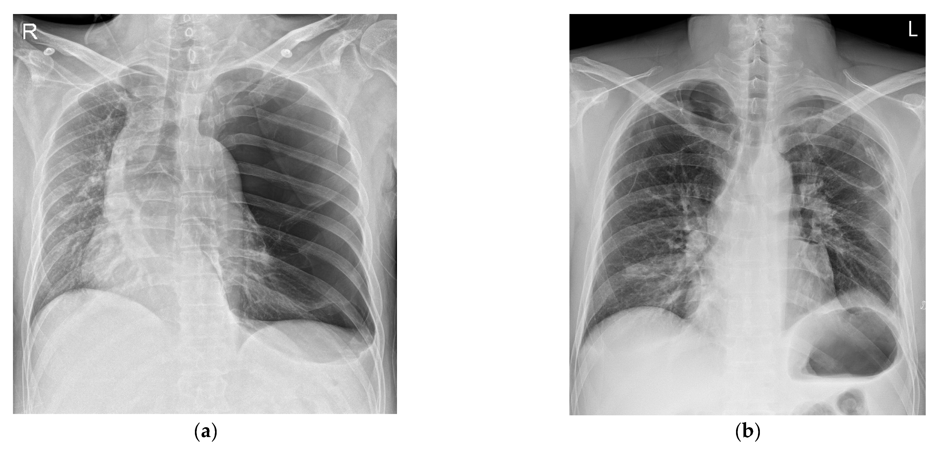 Medicina Free FullText Cardiovascular Collapse after the Induction