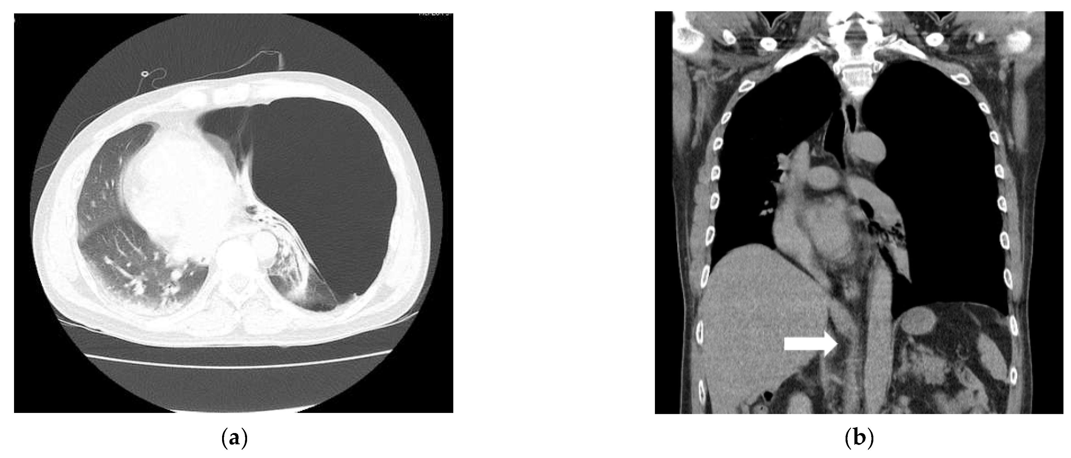Medicina 59 01689 g002