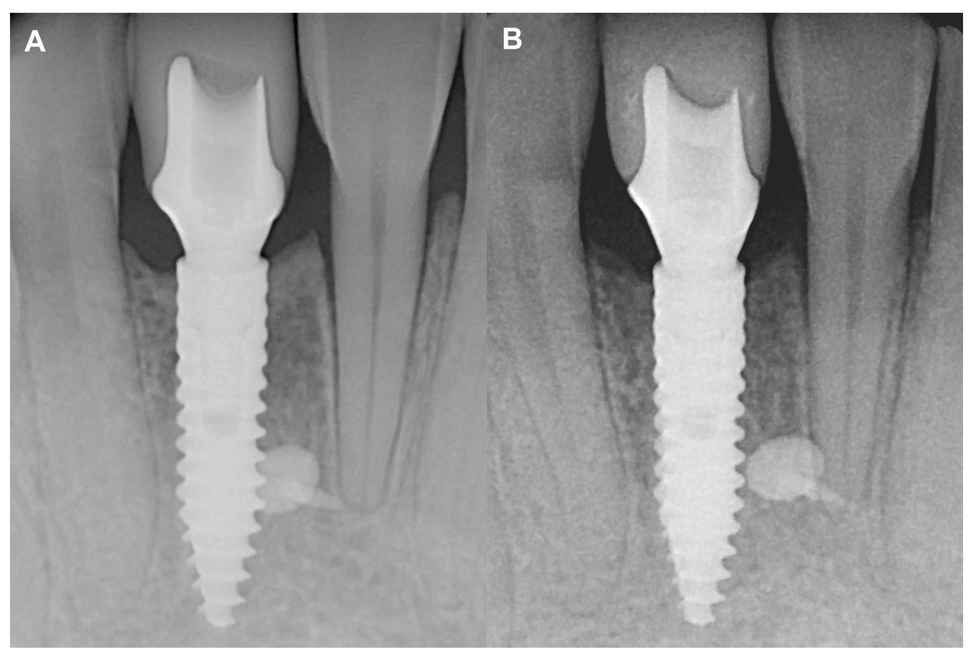 Medicina 59 01698 g005