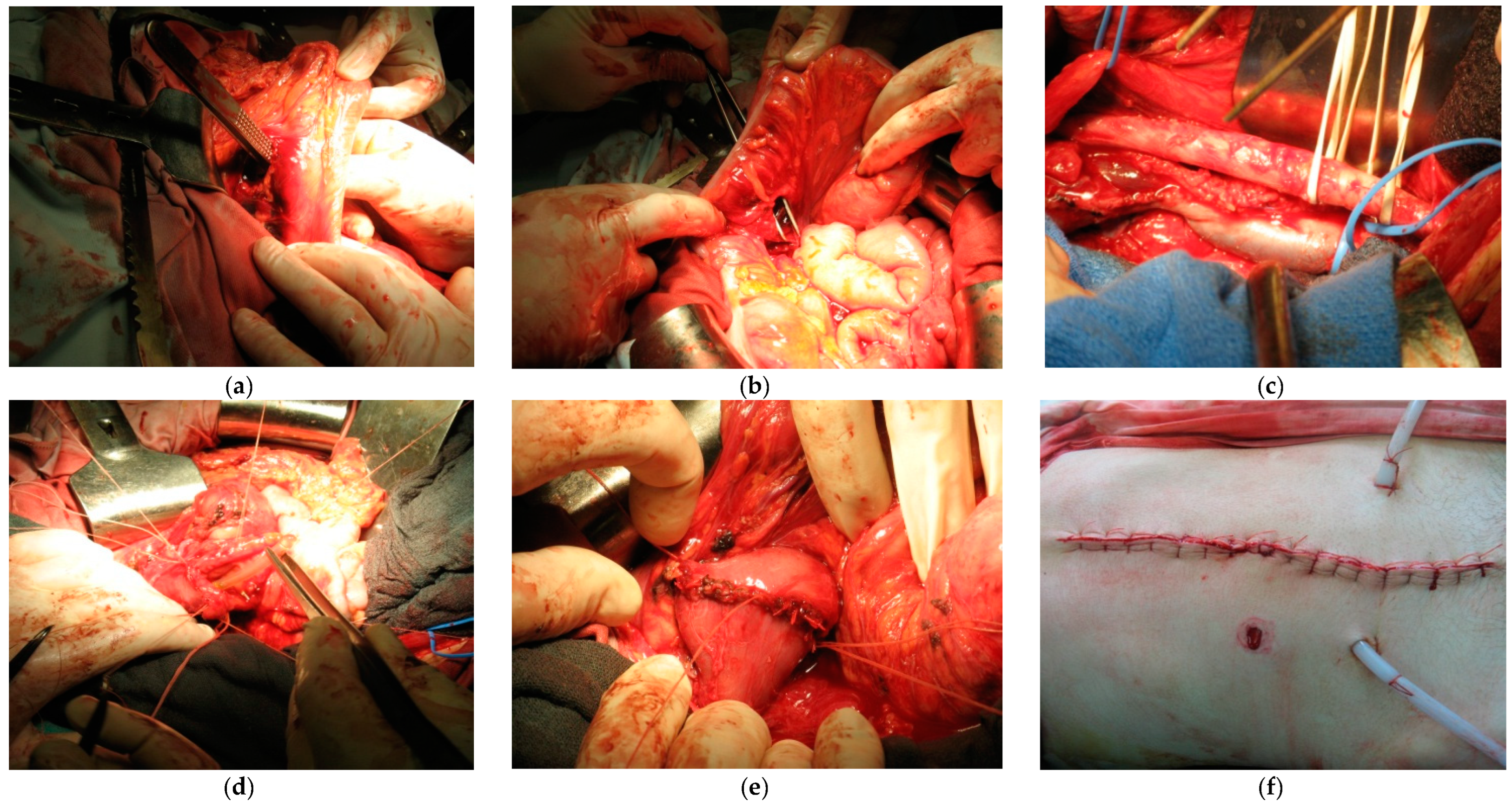 Medicina 59 01713 g002 Medicina 59 01713 g002
