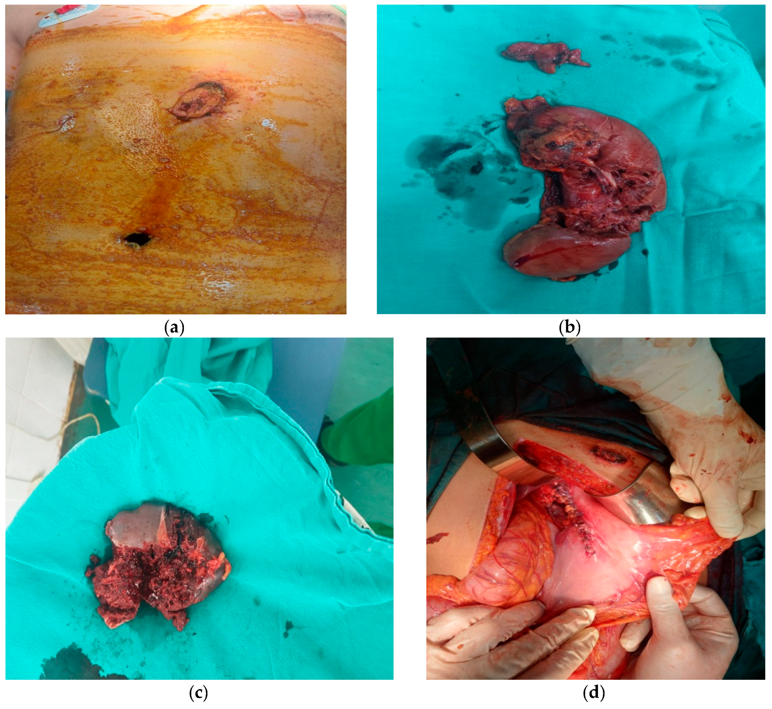Medicina 59 01713 g003 Medicina 59 01713 g003
