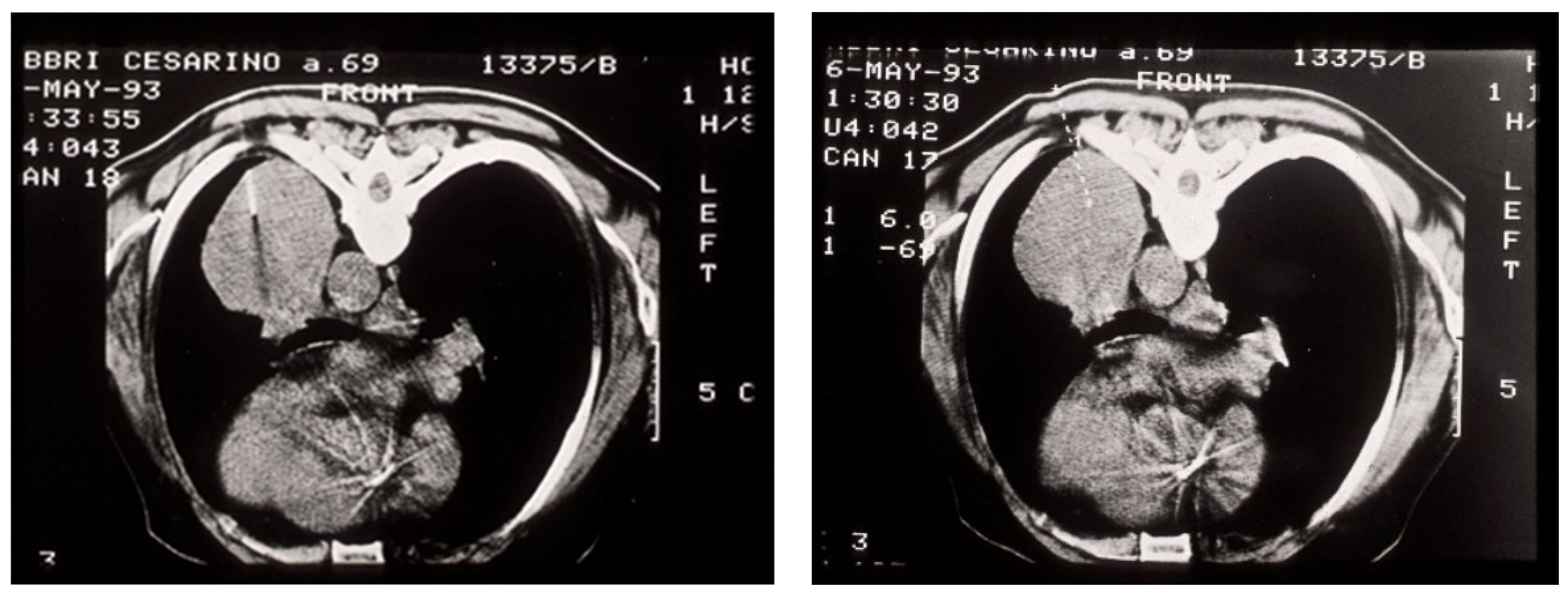 Medicina 59 01723 g005