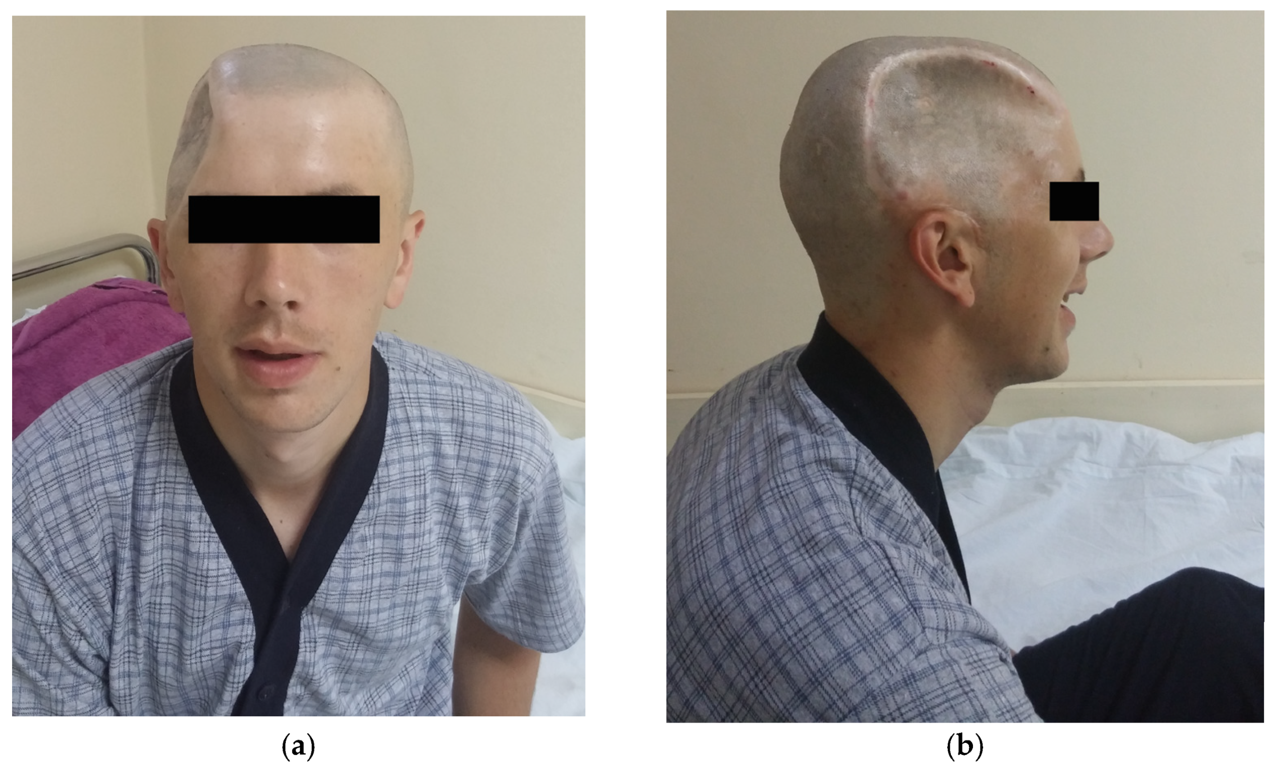 Medicina 59 01732 g004