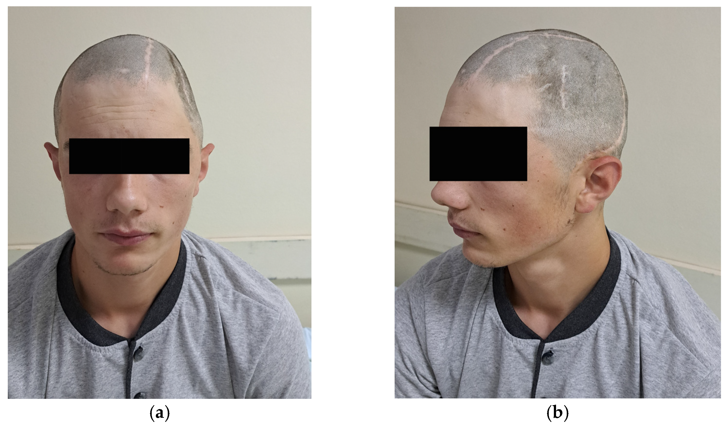 Medicina 59 01732 g005