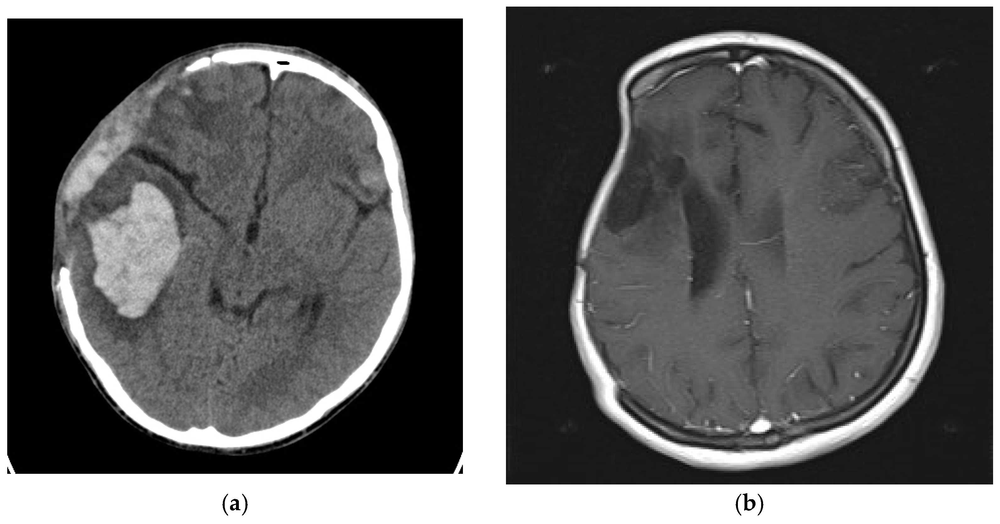Medicina 59 01732 g007