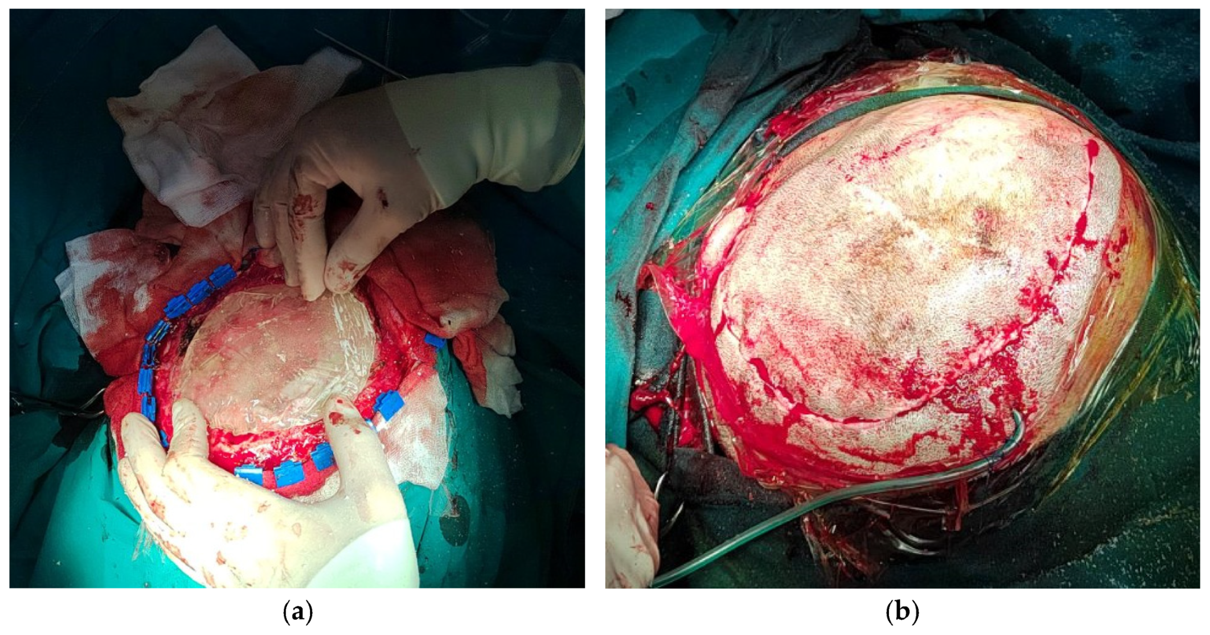 Medicina 59 01732 g009