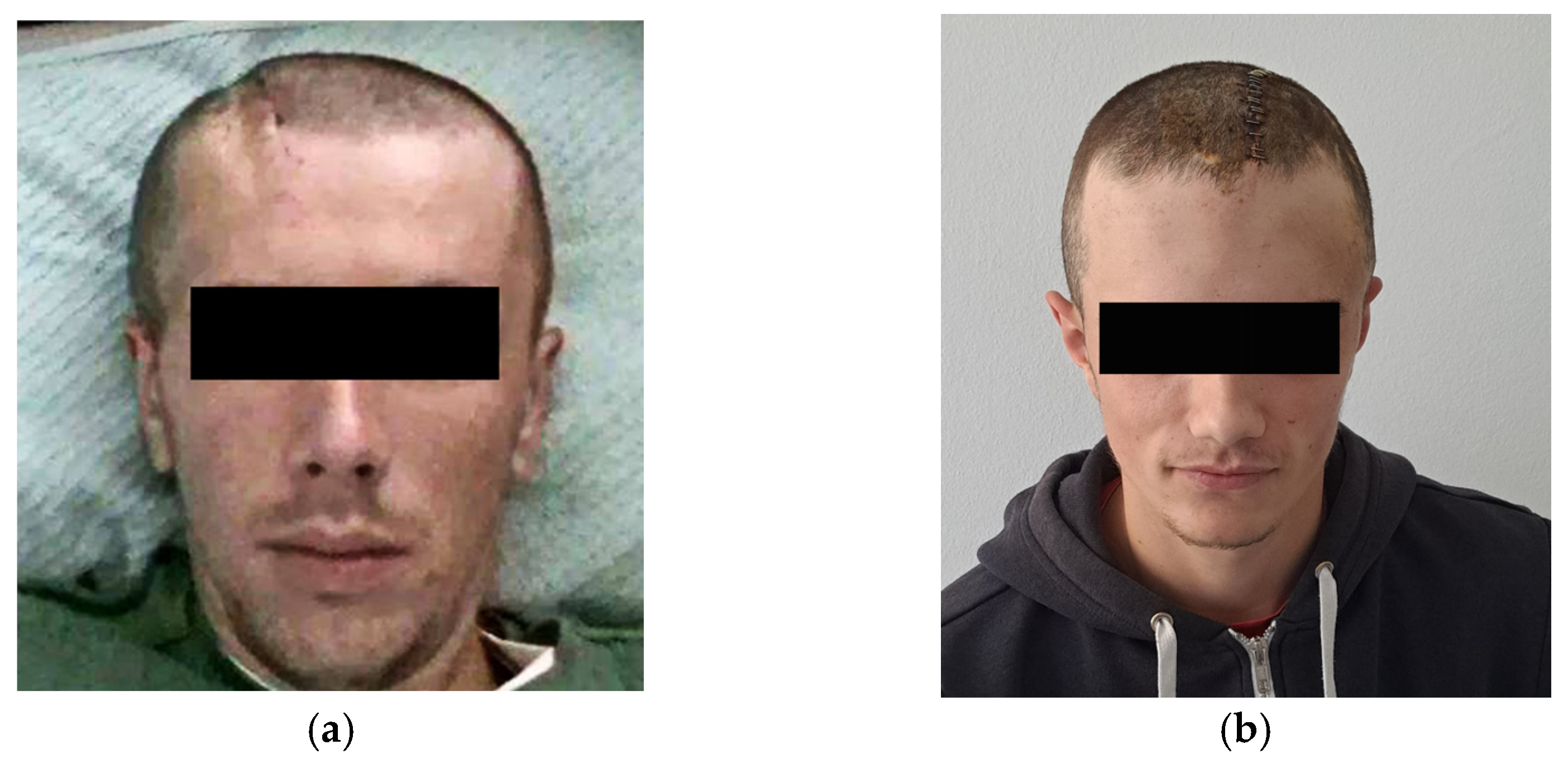 Medicina 59 01732 g010