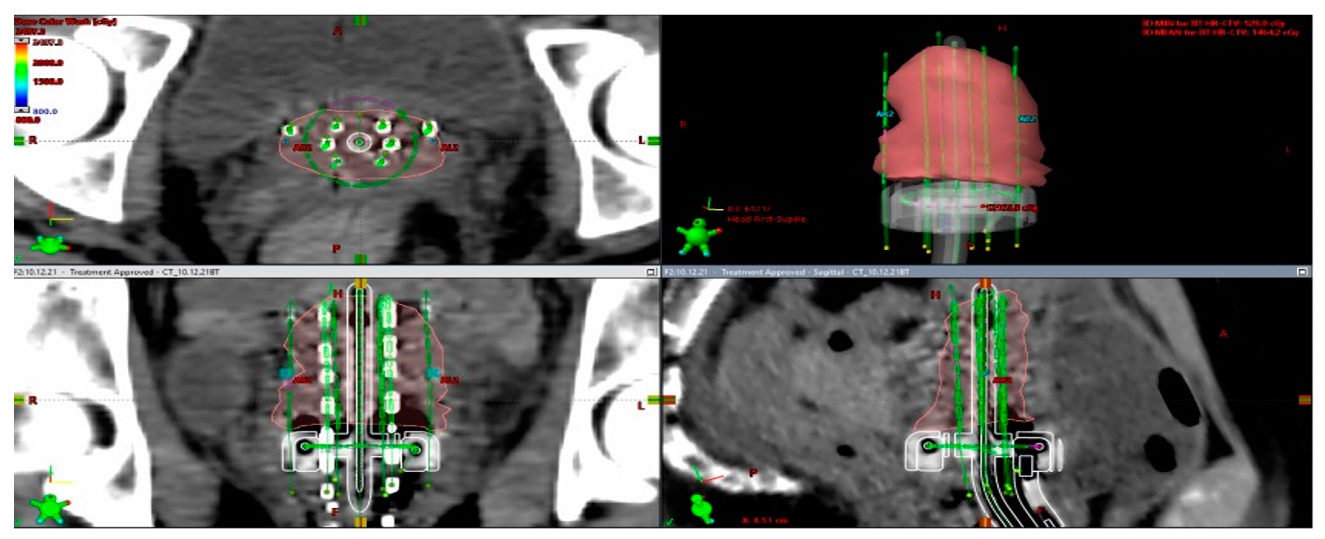 Medicina 59 01735 g011