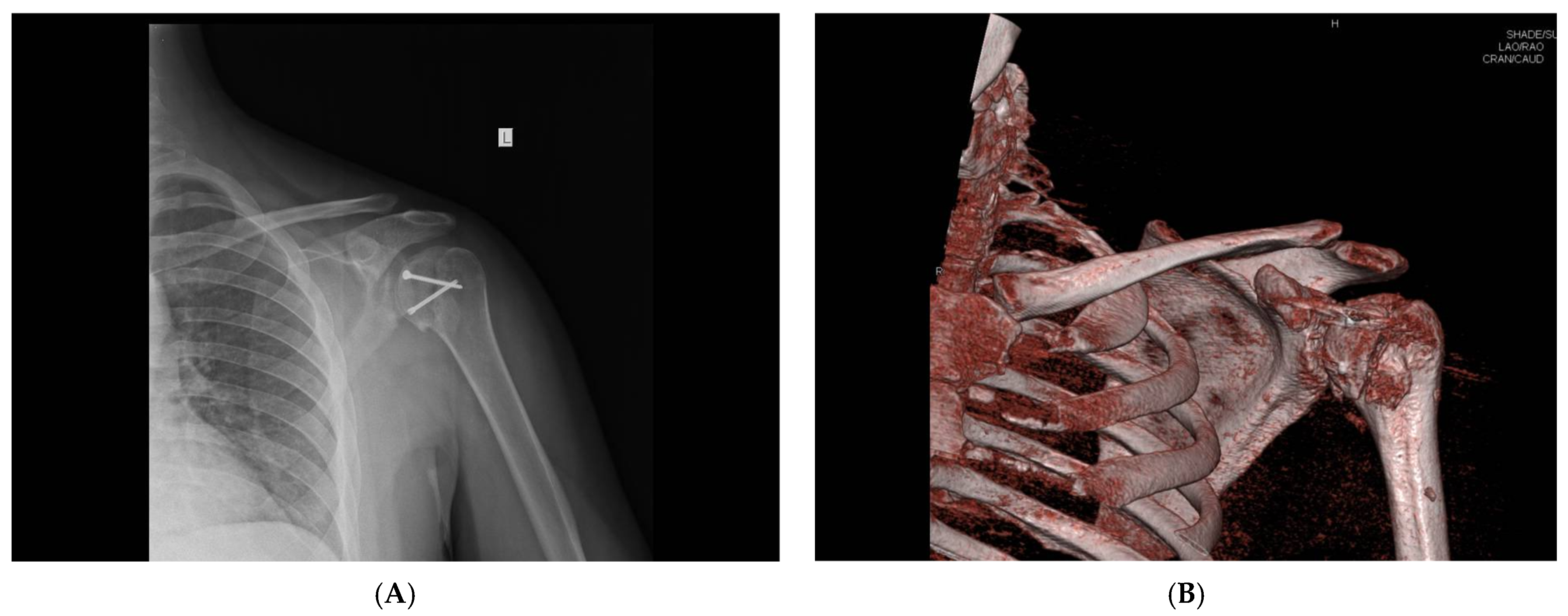 Medicina 59 01736 g005