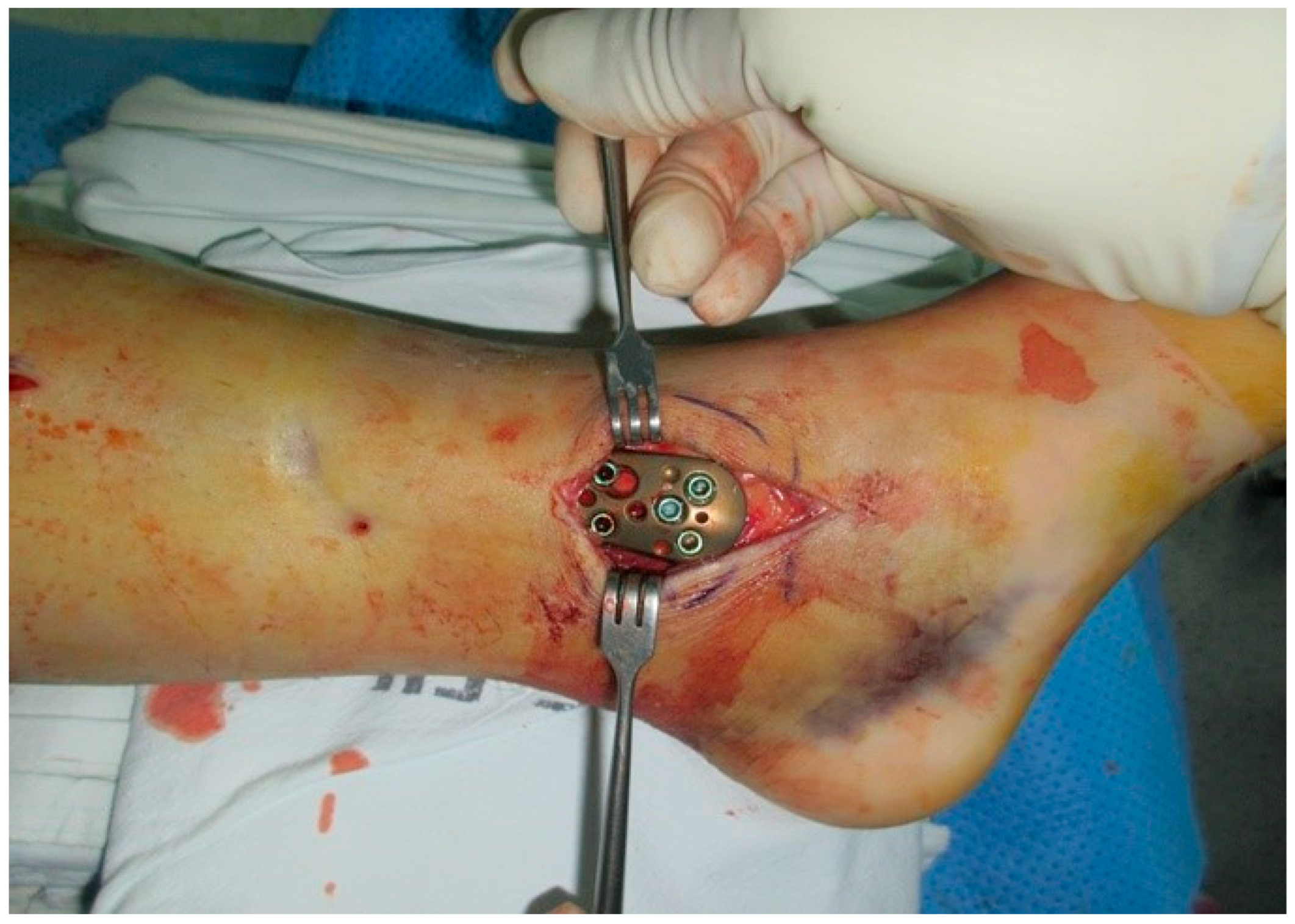 Medicina 59 01751 g004