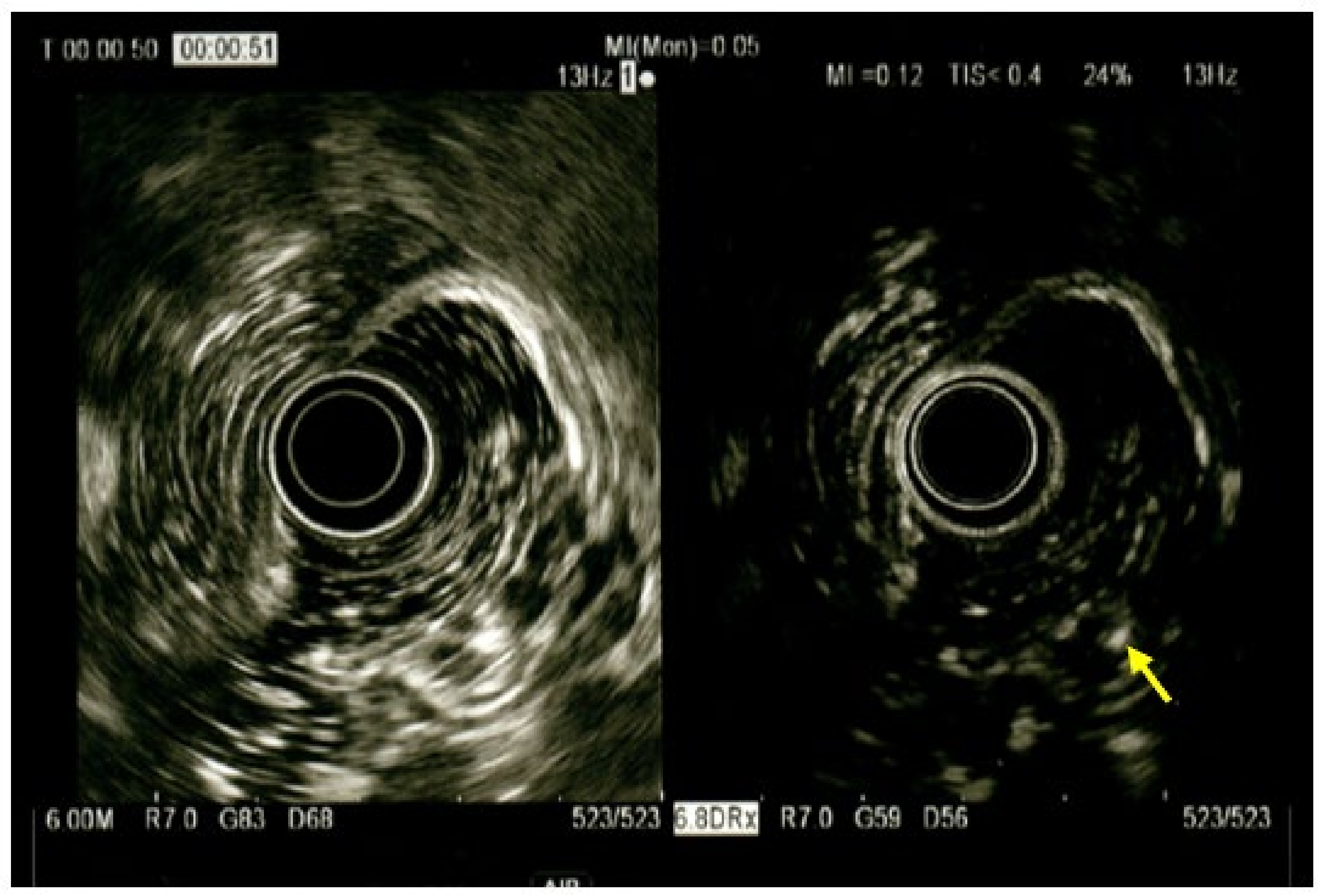 Medicina 59 01770 g005