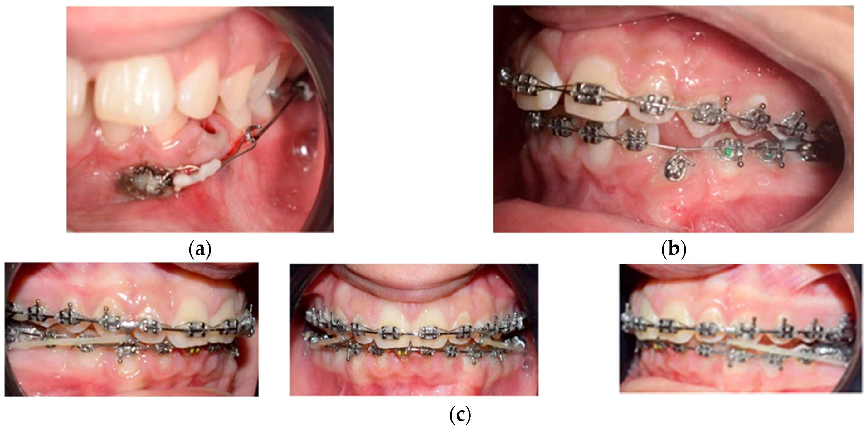 Medicina 59 01774 g003 Medicina 59 01774 g003