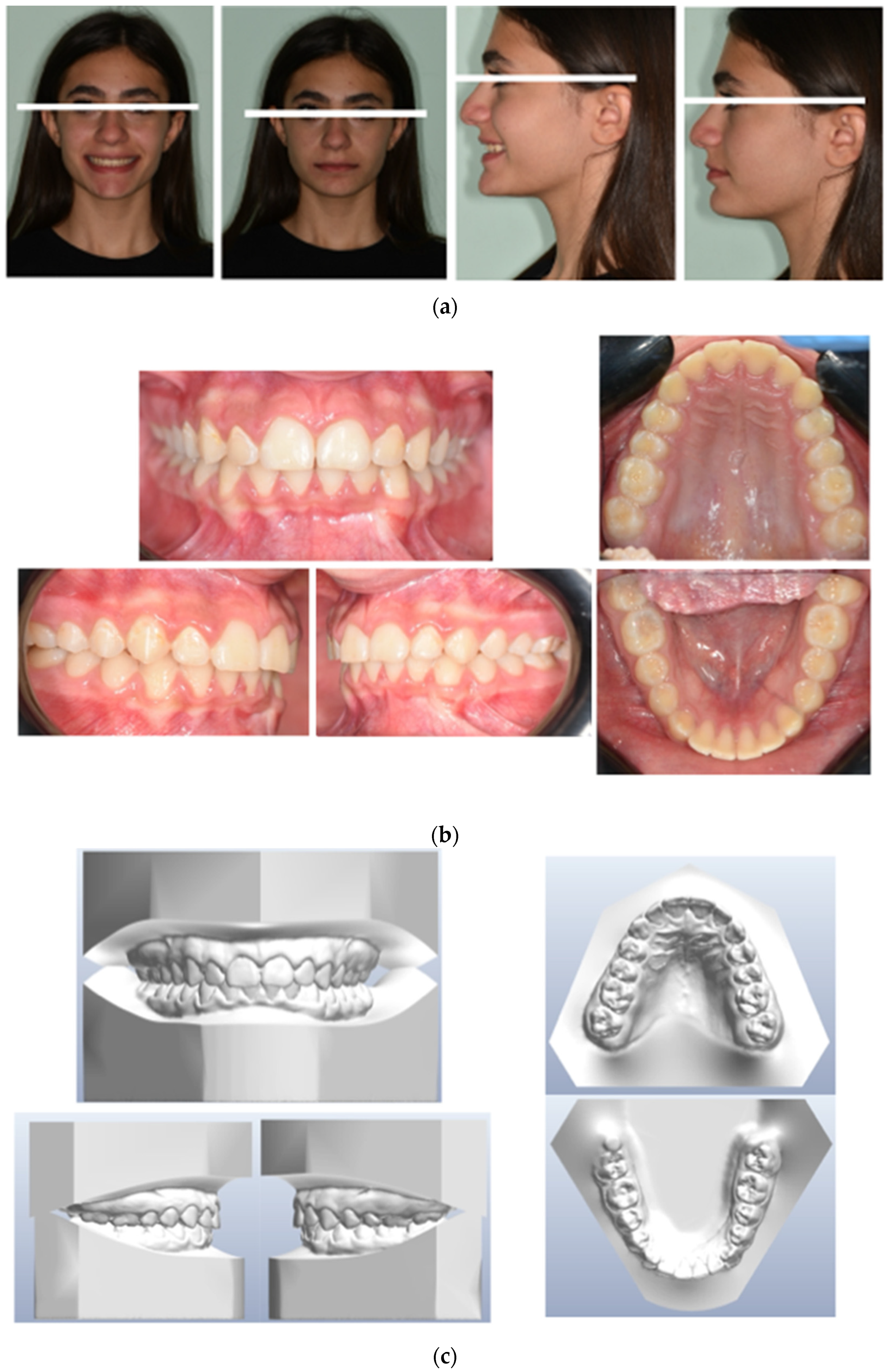 Medicina 59 01774 g004 Medicina 59 01774 g004