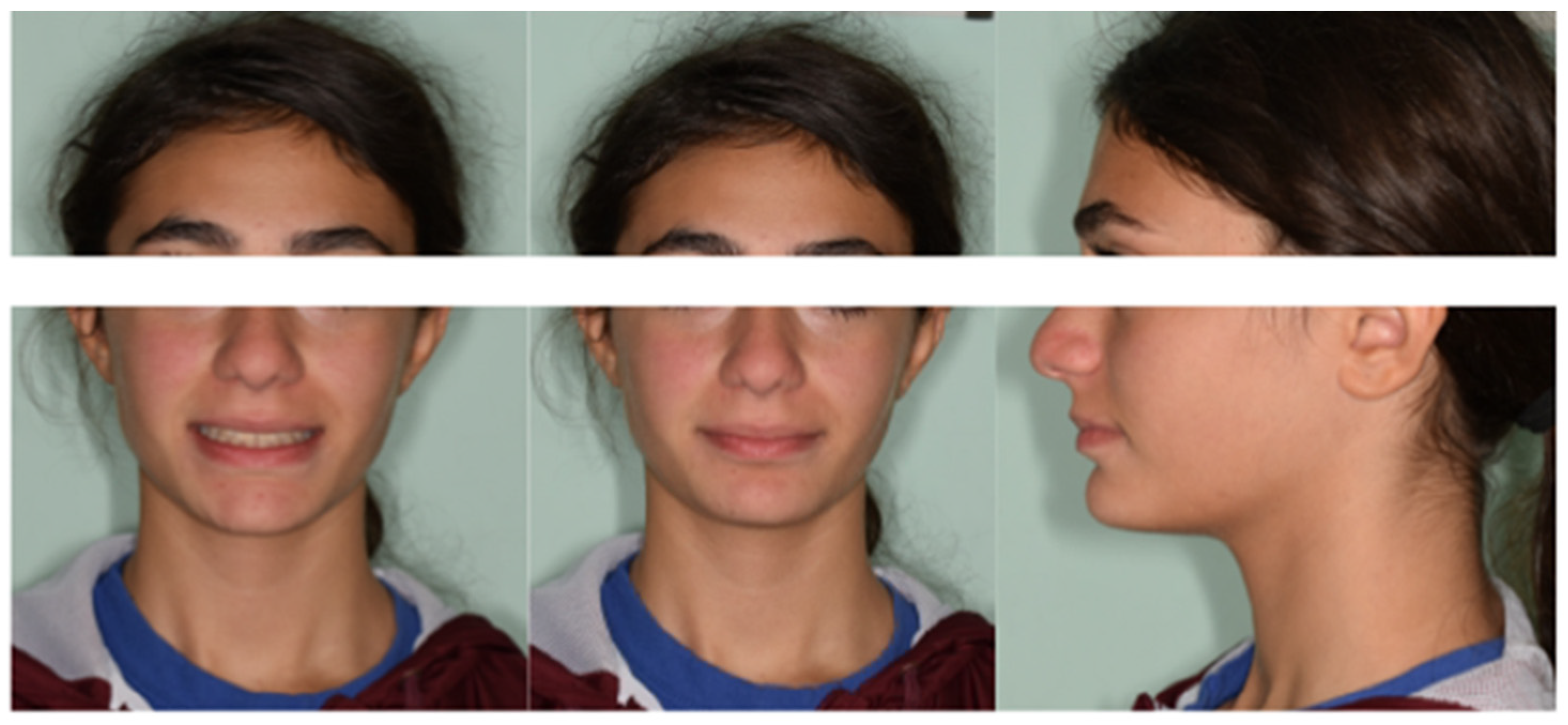 Medicina 59 01774 g006a Medicina 59 01774 g006a