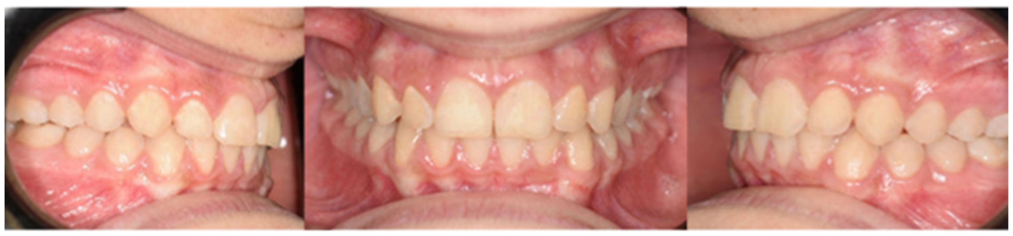 Medicina 59 01774 g006b Medicina 59 01774 g006b